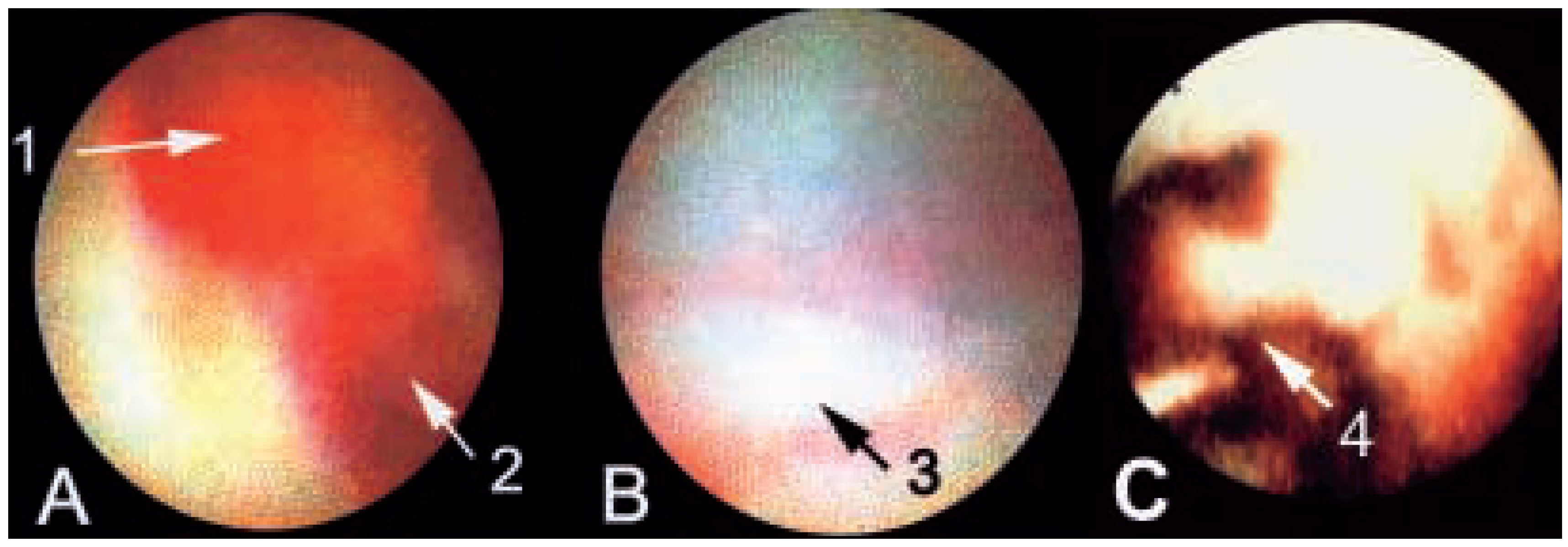 Cardiovascmed 07 00349 g002 Cardiovascmed 07 00349 g002