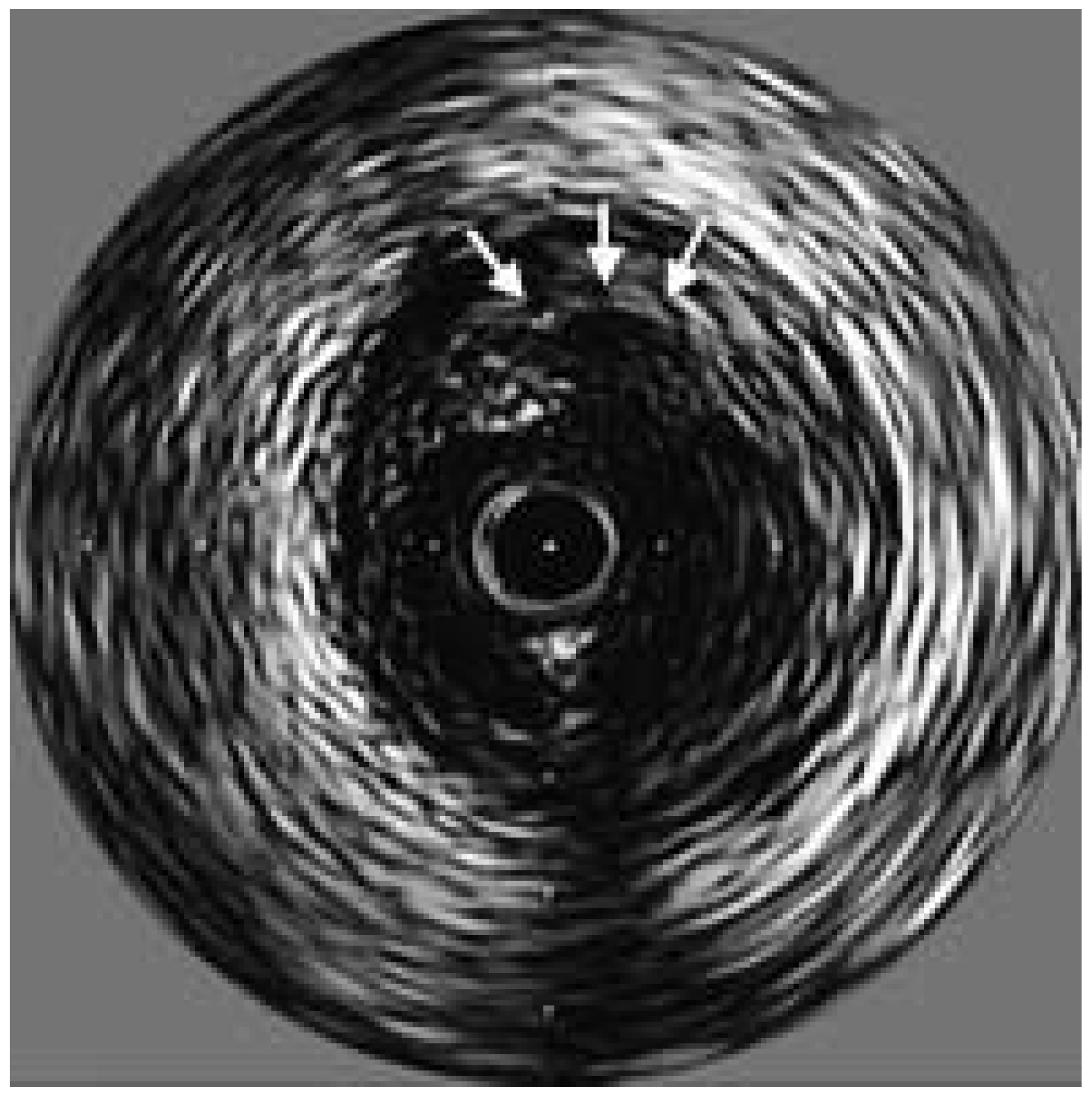 Cardiovascmed 07 00349 g003 Cardiovascmed 07 00349 g003