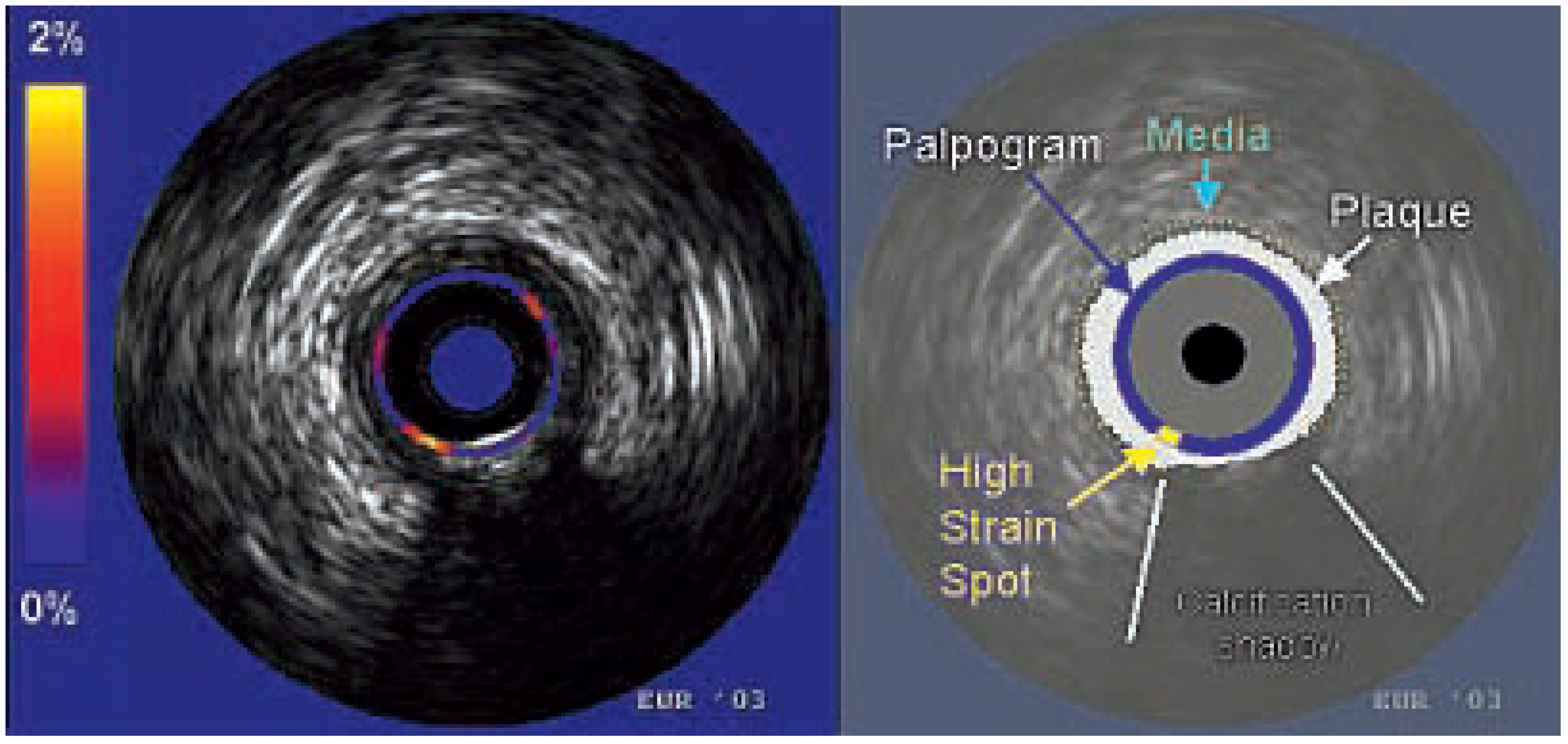 Cardiovascmed 07 00349 g004 Cardiovascmed 07 00349 g004