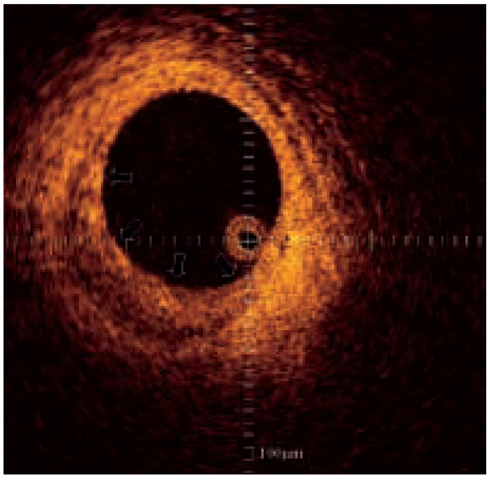 Cardiovascmed 07 00349 g005 Cardiovascmed 07 00349 g005