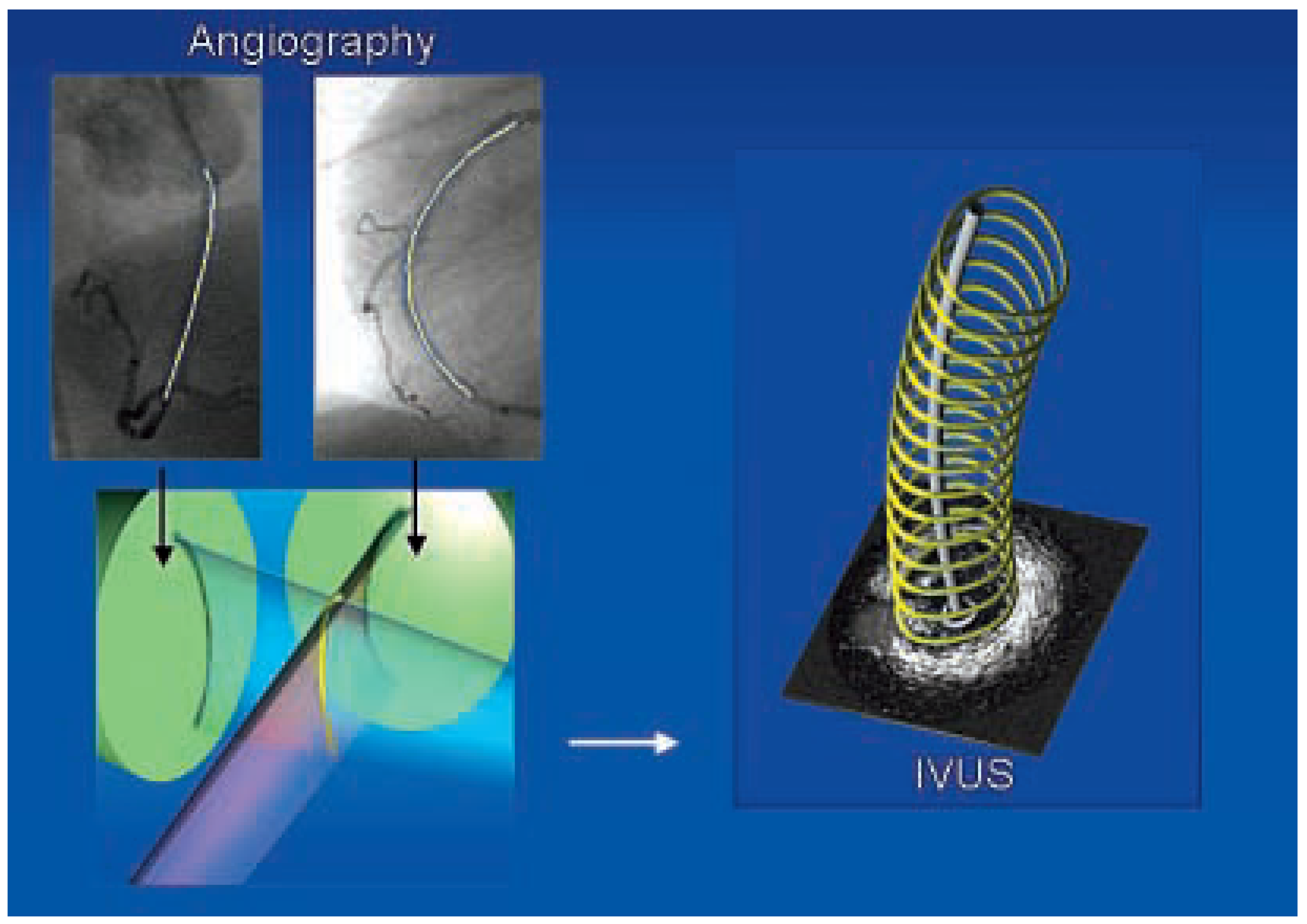 Cardiovascmed 07 00349 g006 Cardiovascmed 07 00349 g006