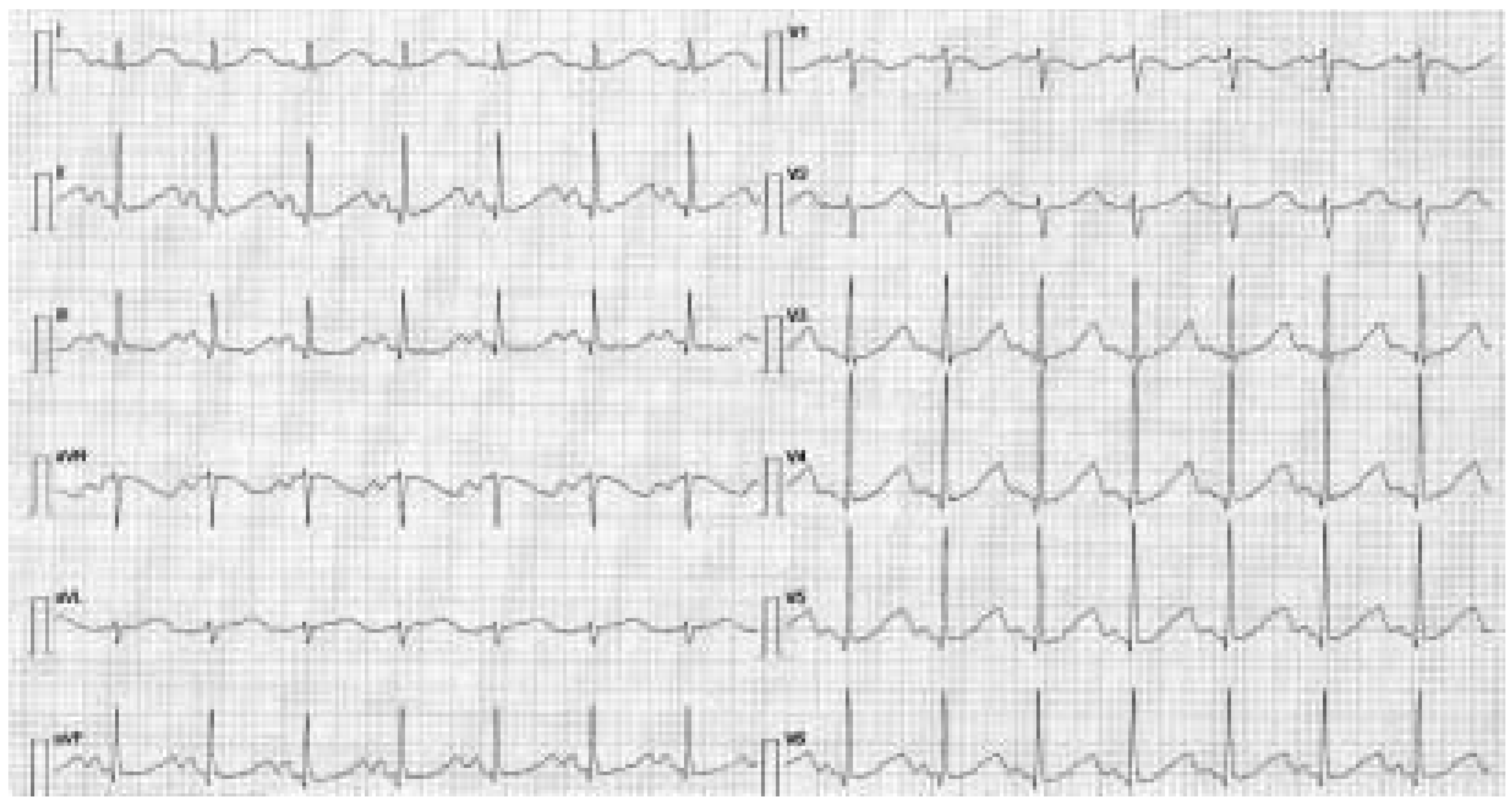 Cardiovascmed 07 00421 g001