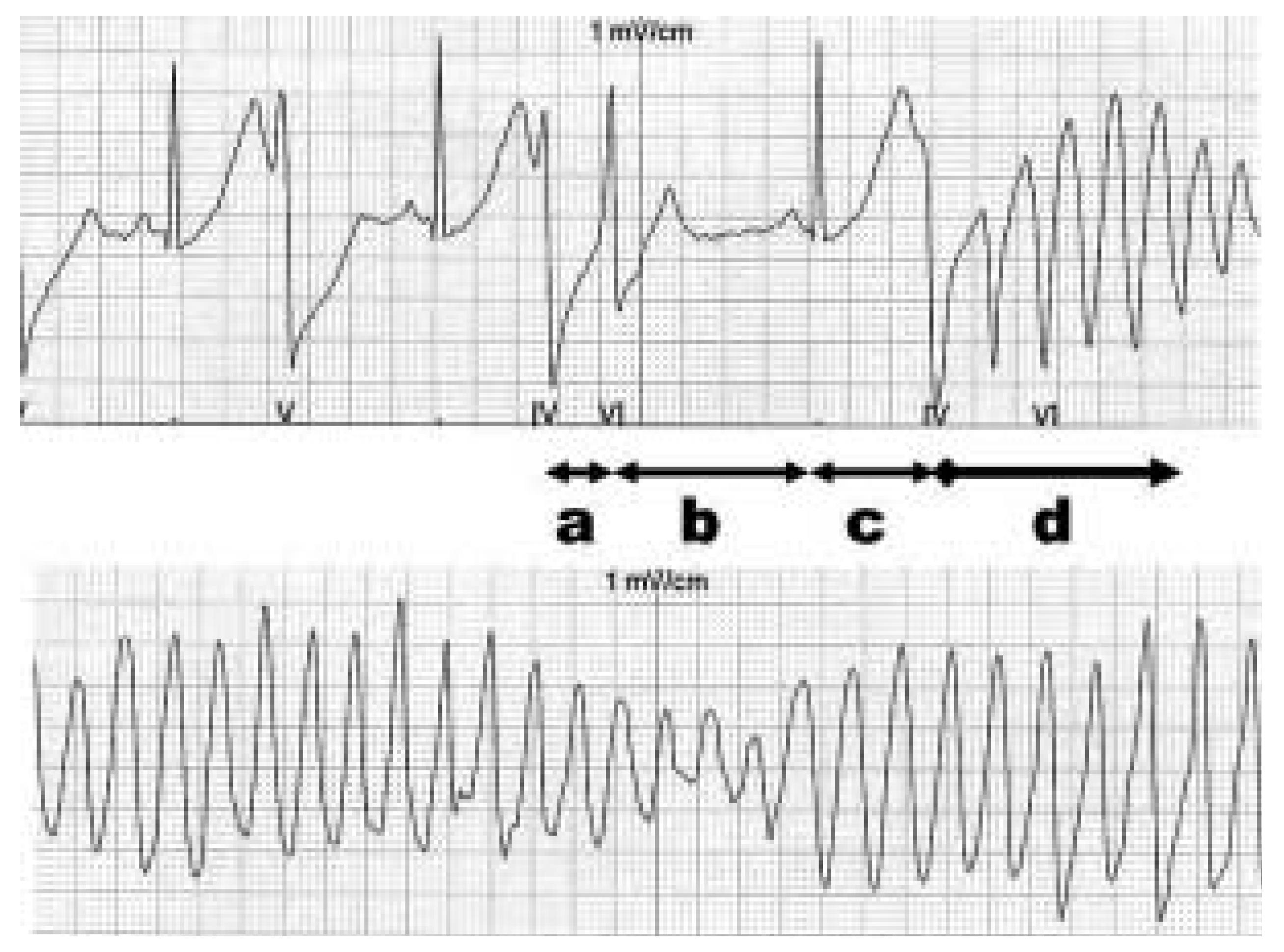 Cardiovascmed 07 00421 g002