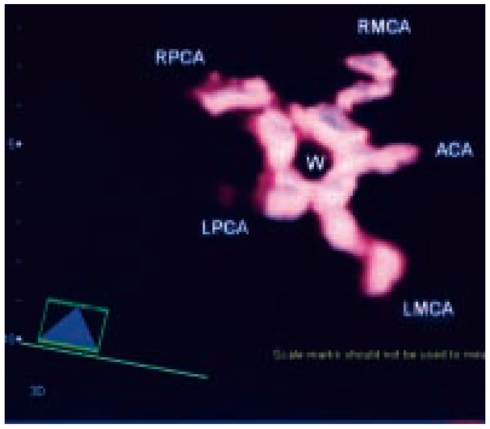 Cardiovascmed 07 00423 g001