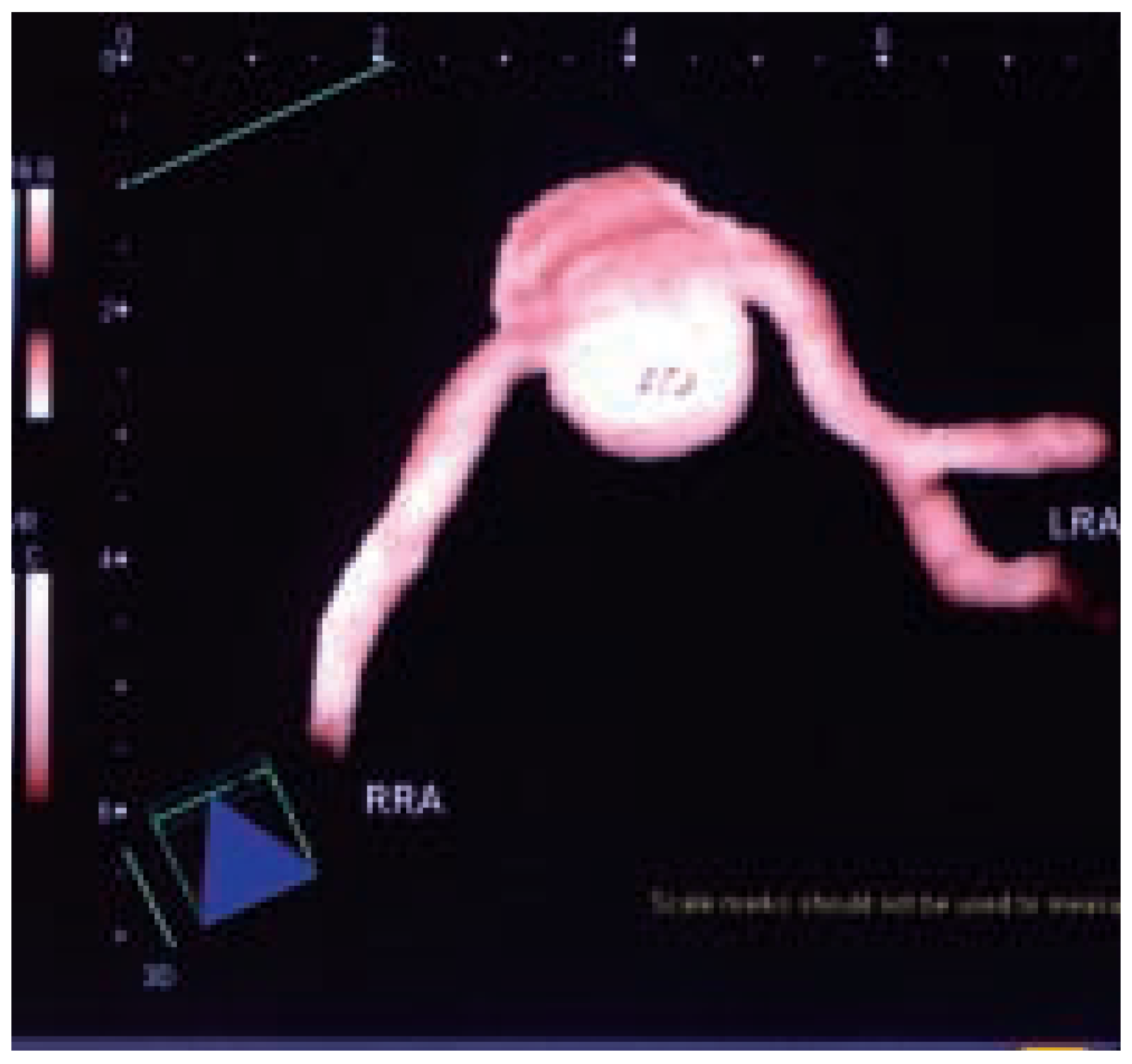 Cardiovascmed 07 00423 g004