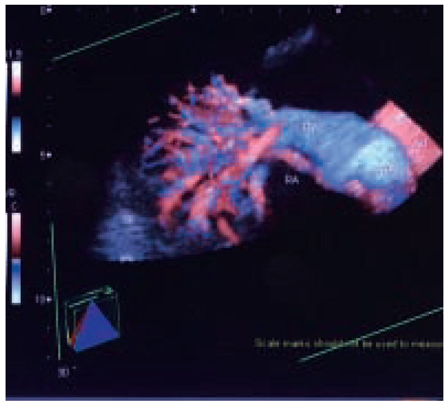Cardiovascmed 07 00423 g005