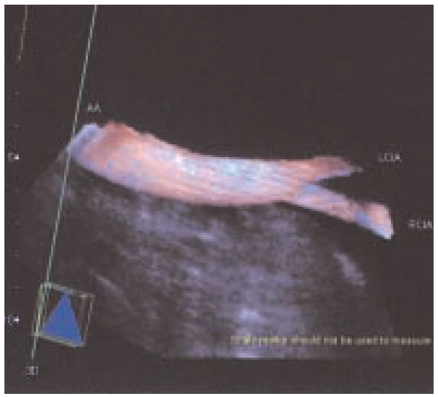 Cardiovascmed 07 00423 g006