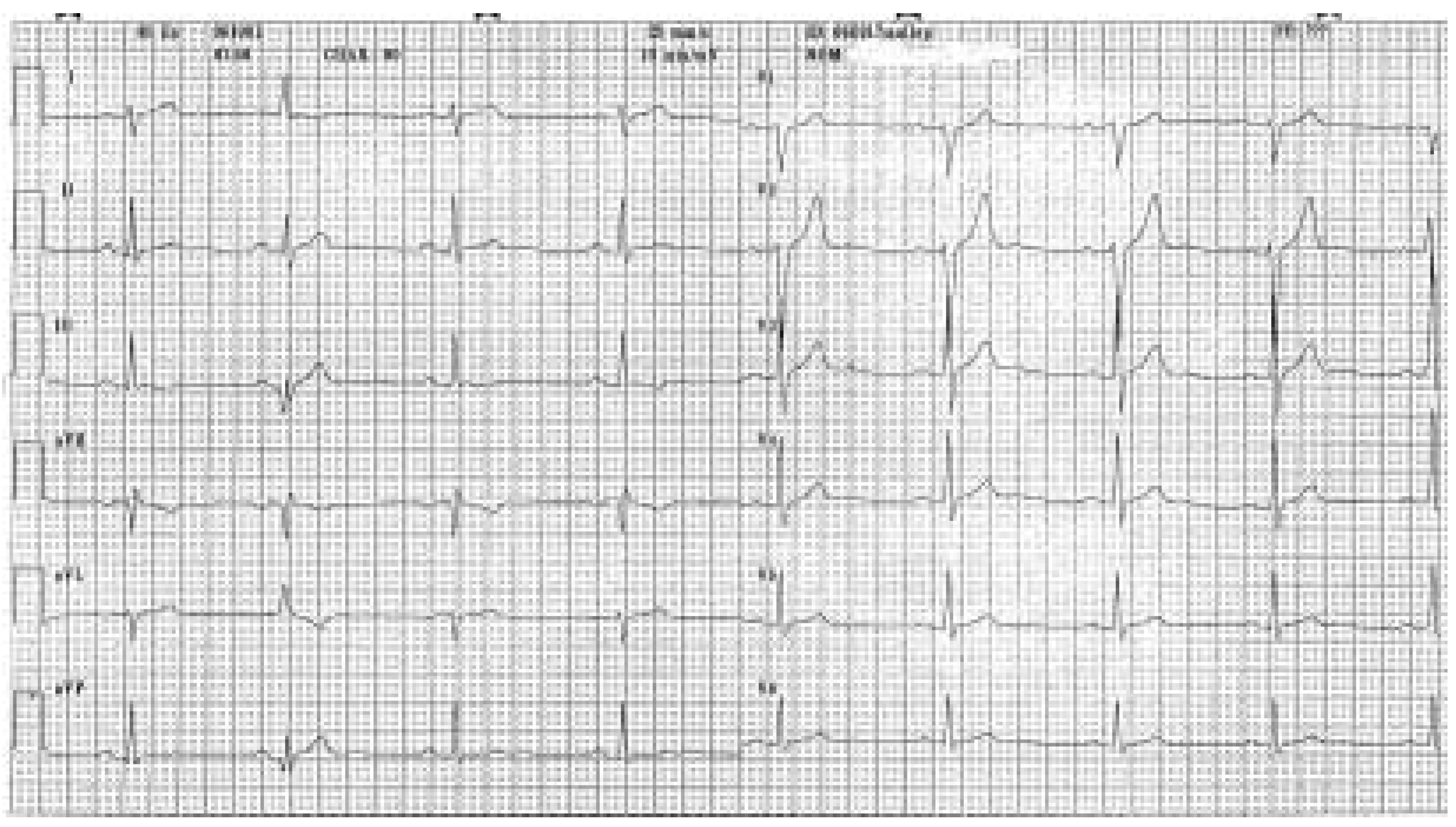 Cardiovascmed 07 00465 g001 Cardiovascmed 07 00465 g001