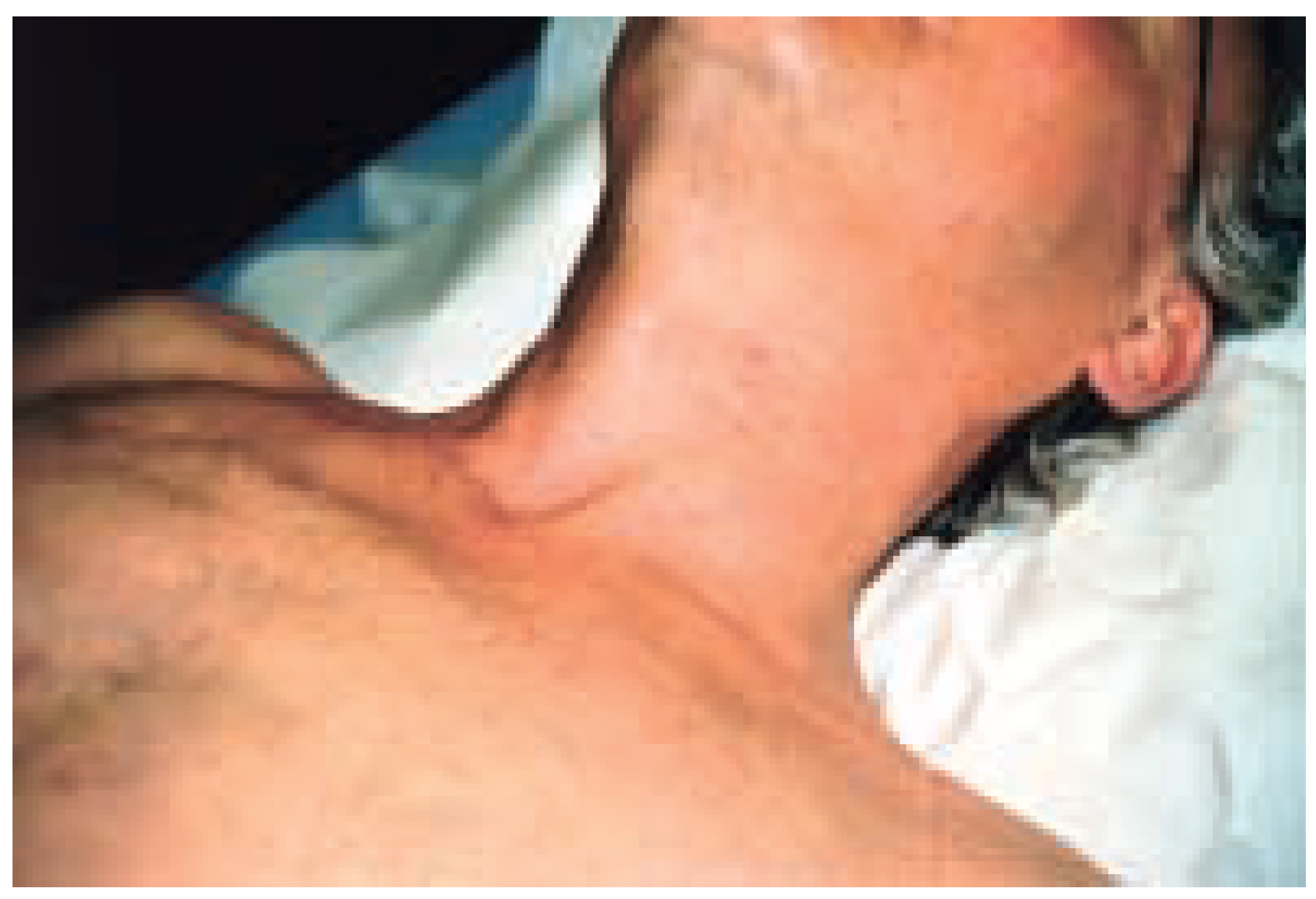 Cardiovascmed 08 00023 g001 Cardiovascmed 08 00023 g001