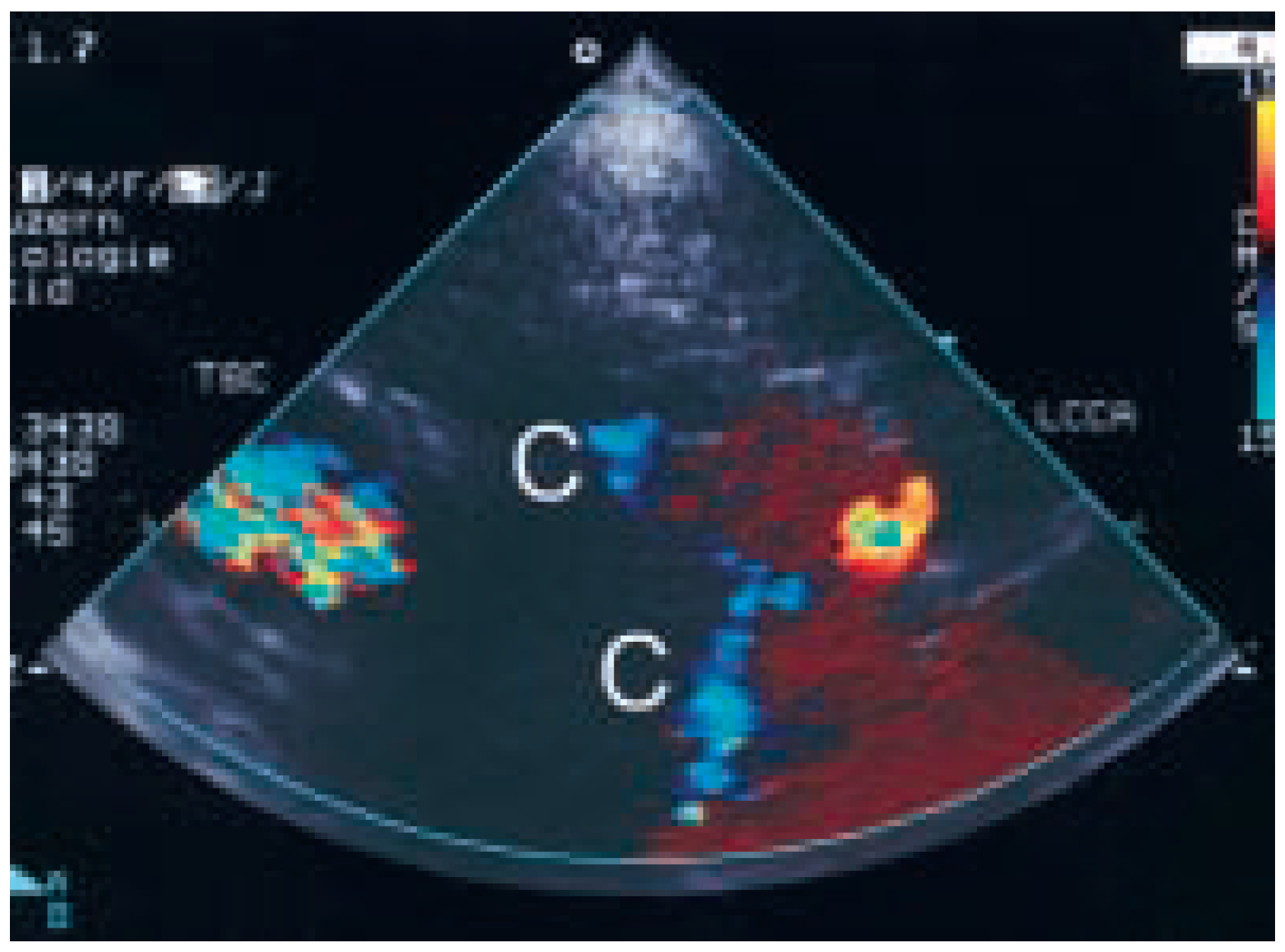 Cardiovascmed 08 00023 g003 Cardiovascmed 08 00023 g003