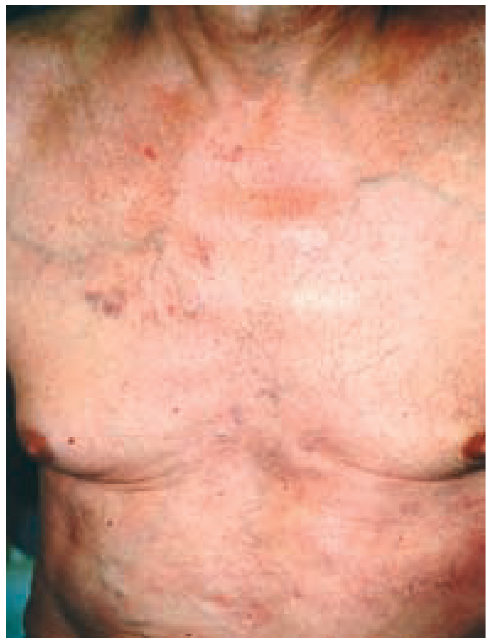 Cardiovascmed 08 00023 g007 Cardiovascmed 08 00023 g007