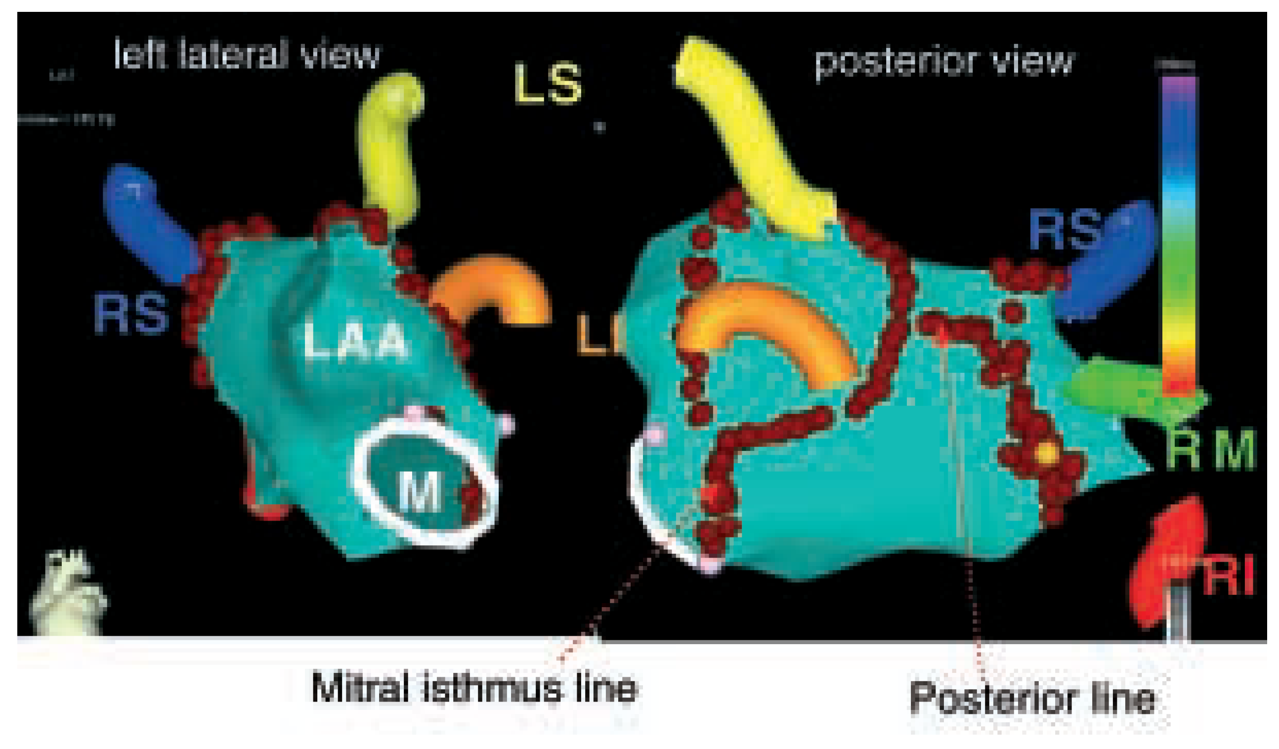 Cardiovascmed 08 00053 g002