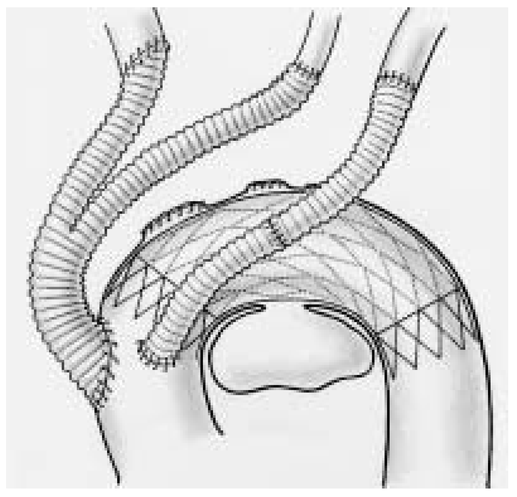 Cardiovascmed 08 00082 g003