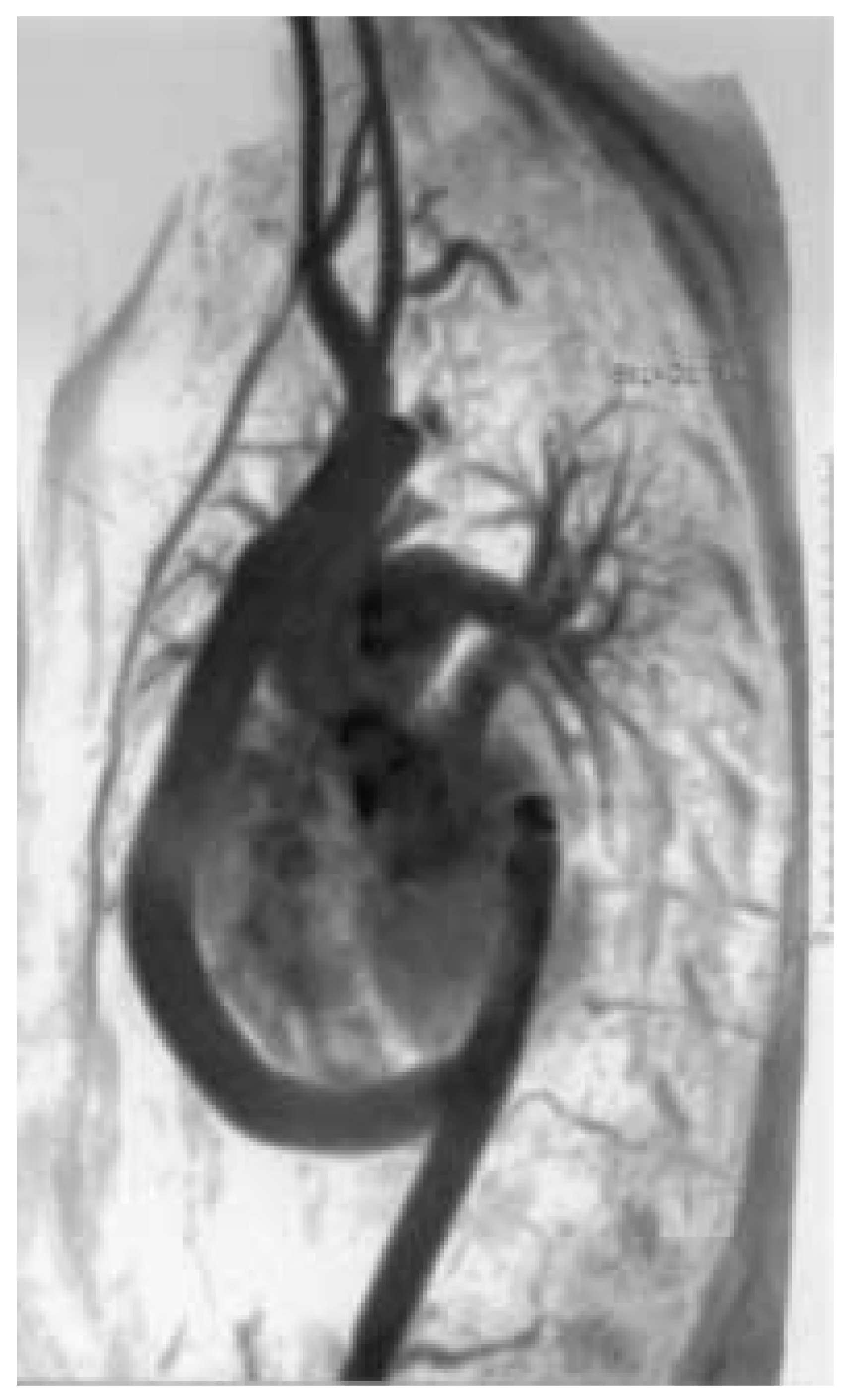 Cardiovascmed 08 00082 g007