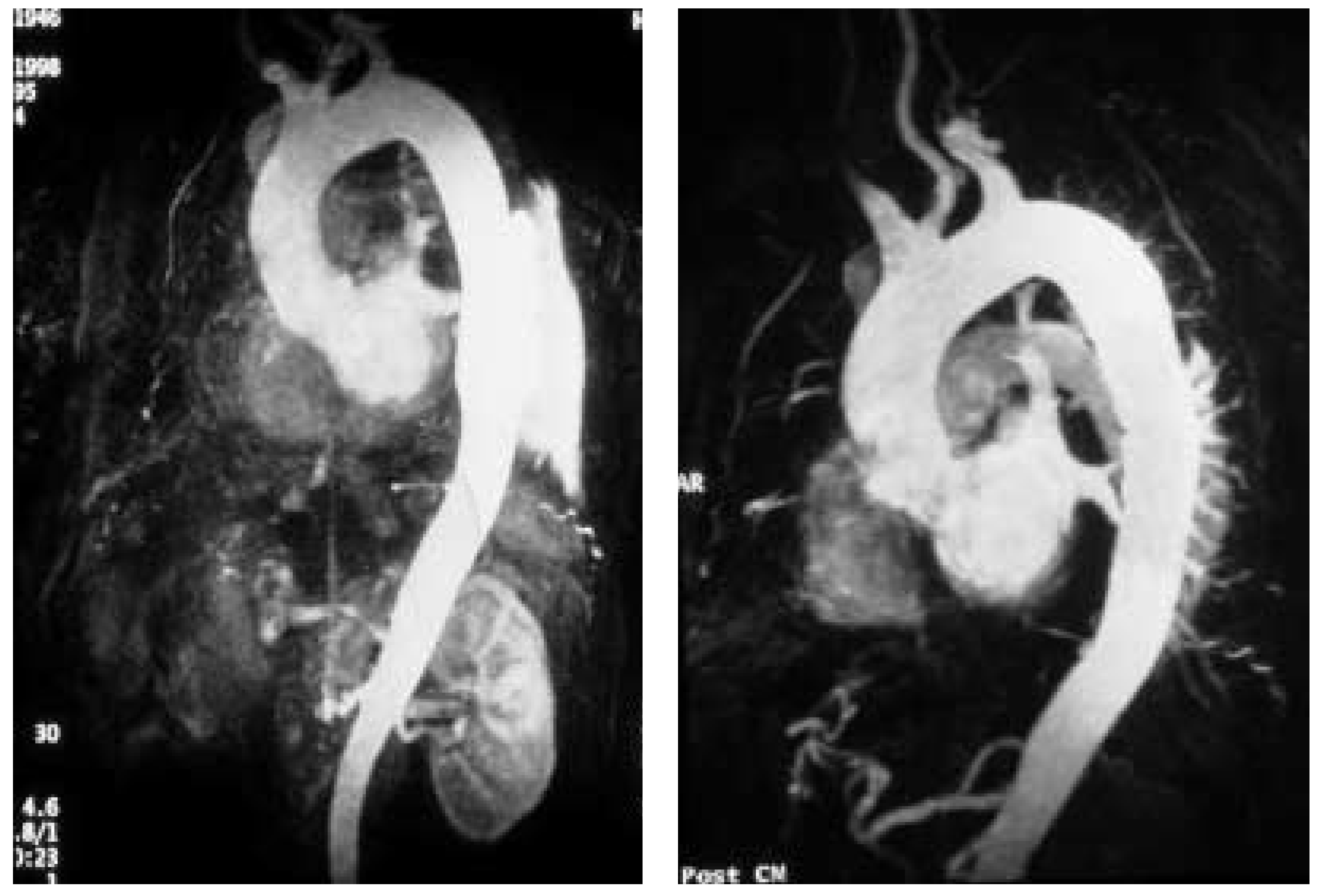 Cardiovascmed 08 00089 g003