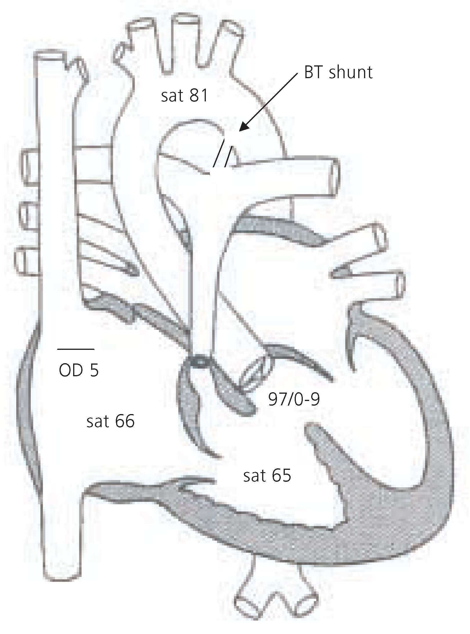 Cardiovascmed 08 00099 g001