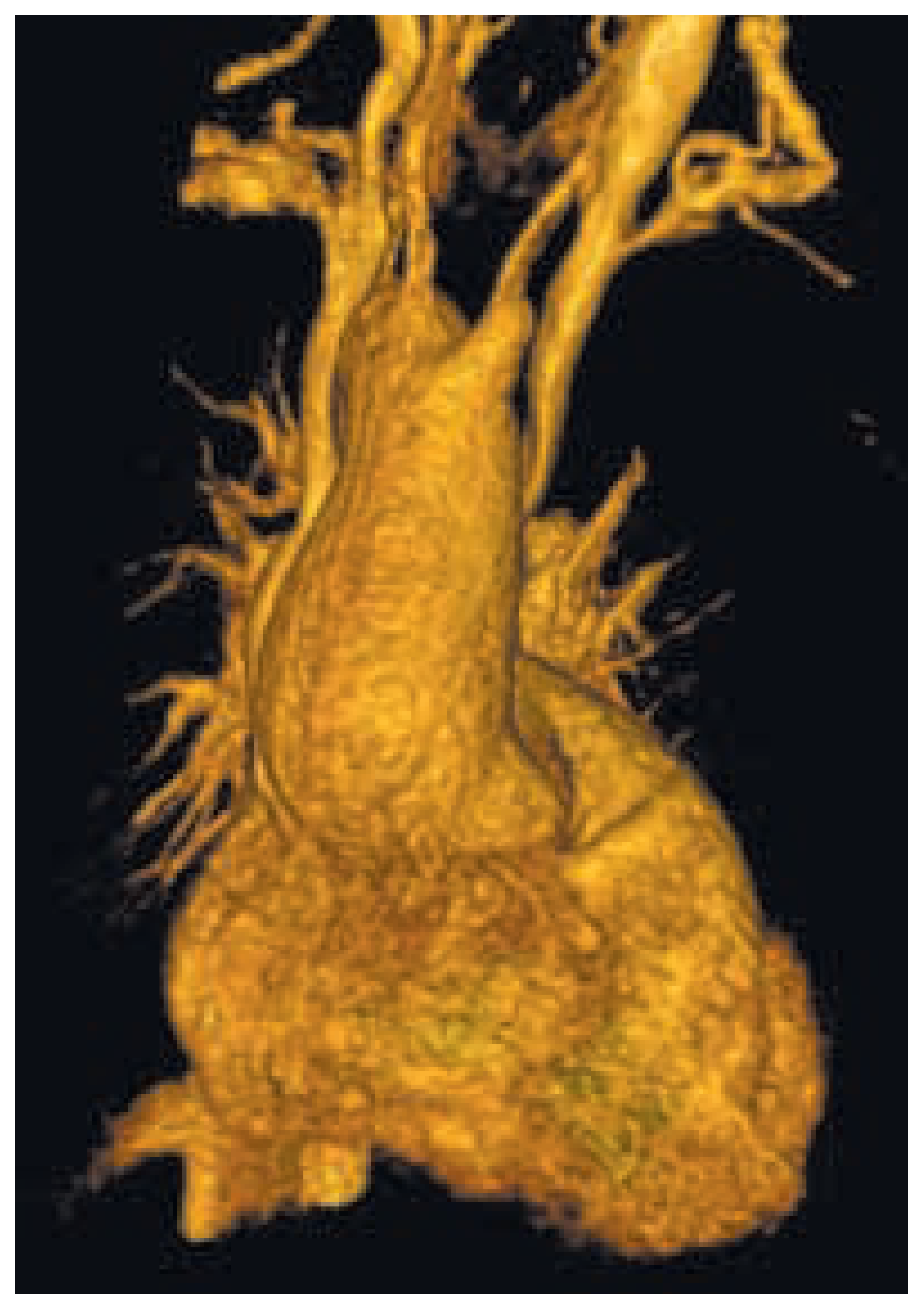 Cardiovascmed 08 00099 g002