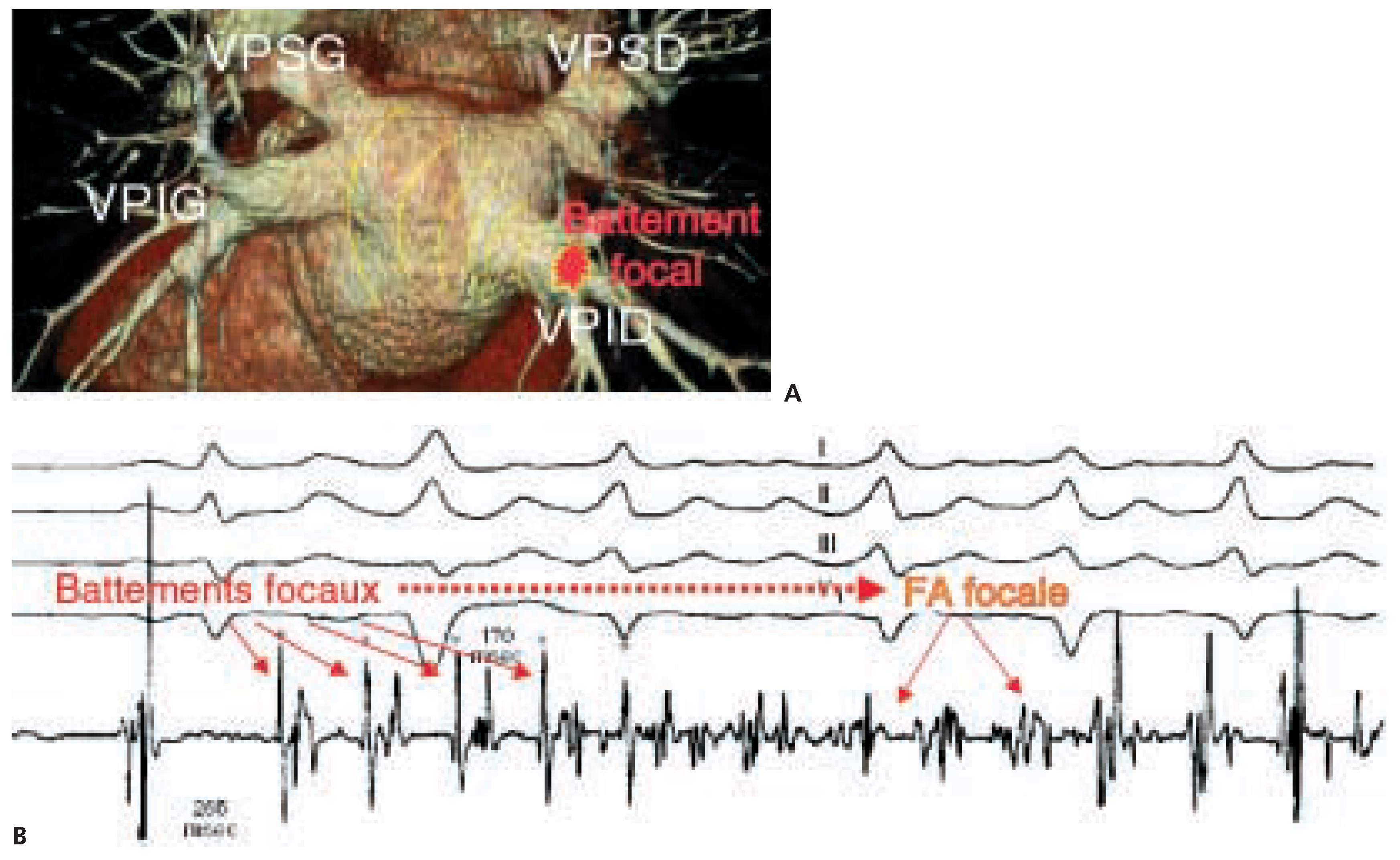 Cardiovascmed 08 00133 g002