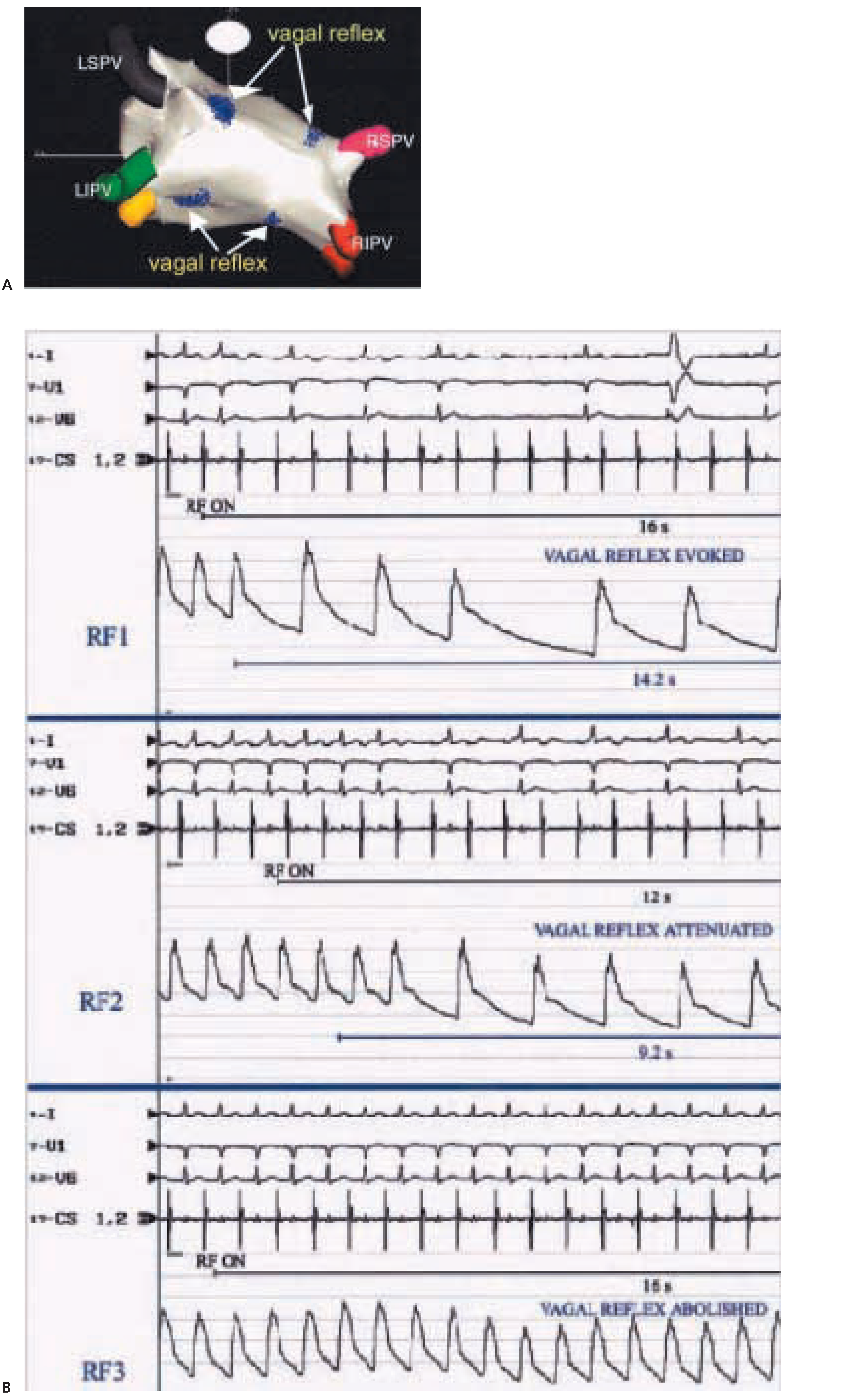 Cardiovascmed 08 00133 g005