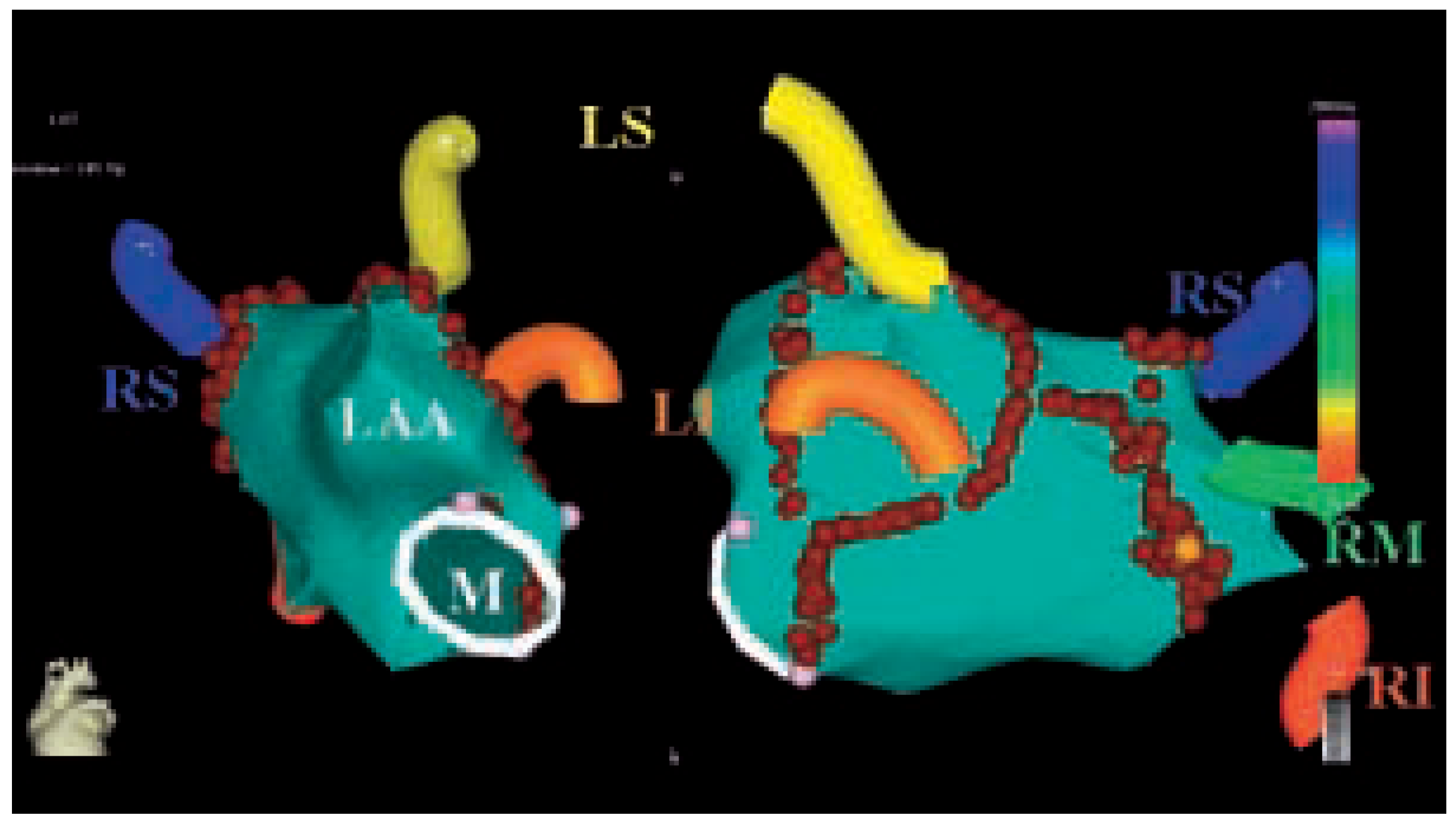 Cardiovascmed 08 00144 g001 Cardiovascmed 08 00144 g001