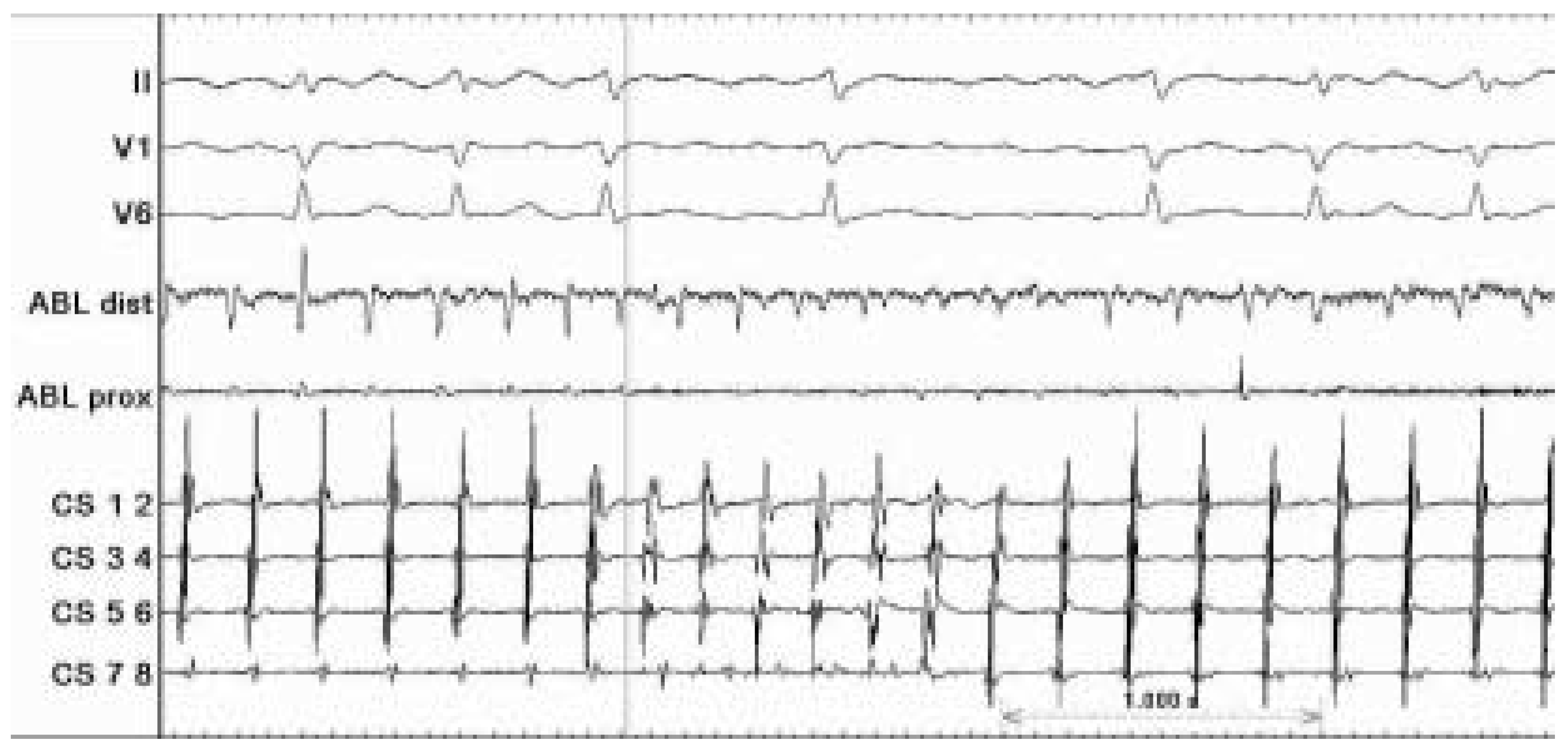 Cardiovascmed 08 00144 g003 Cardiovascmed 08 00144 g003