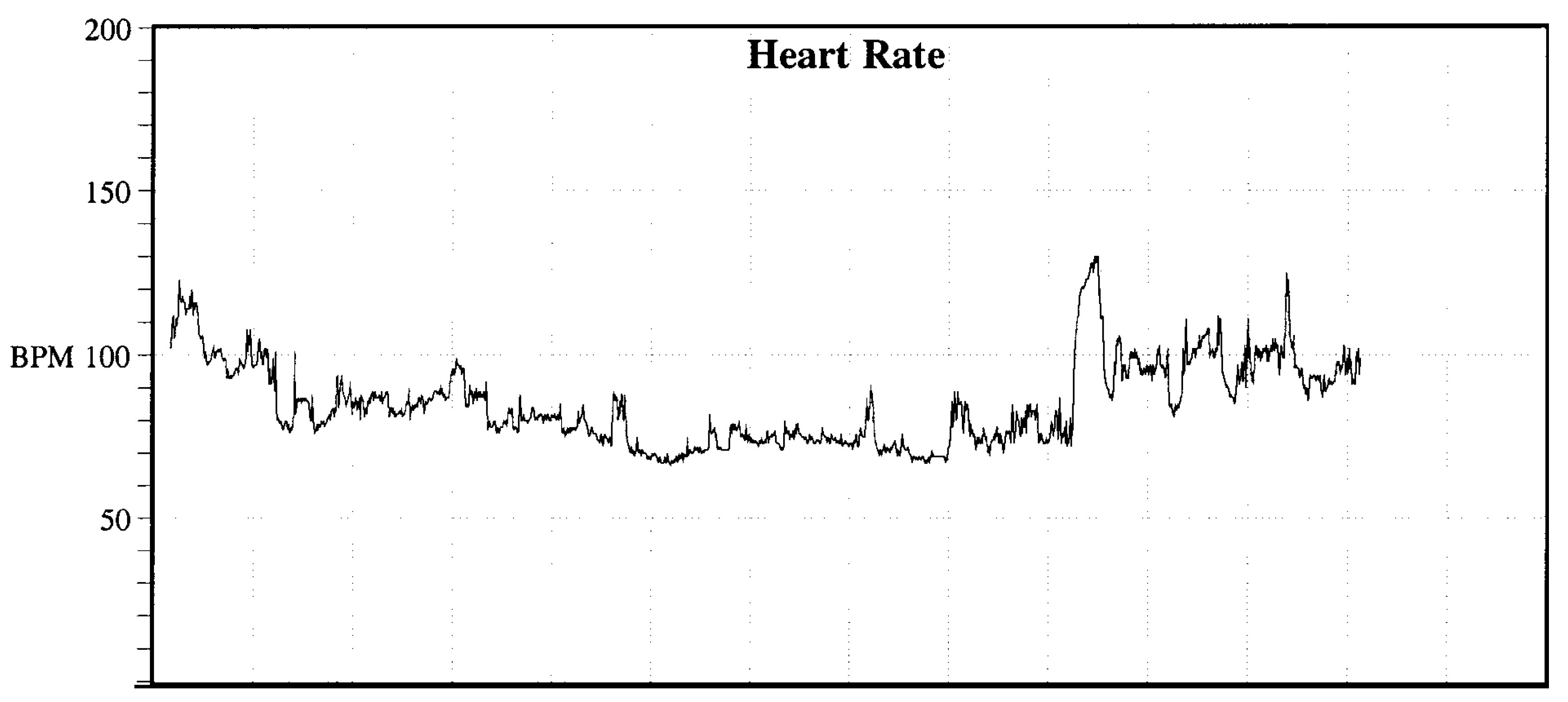 Cardiovascmed 08 00144 g006 Cardiovascmed 08 00144 g006