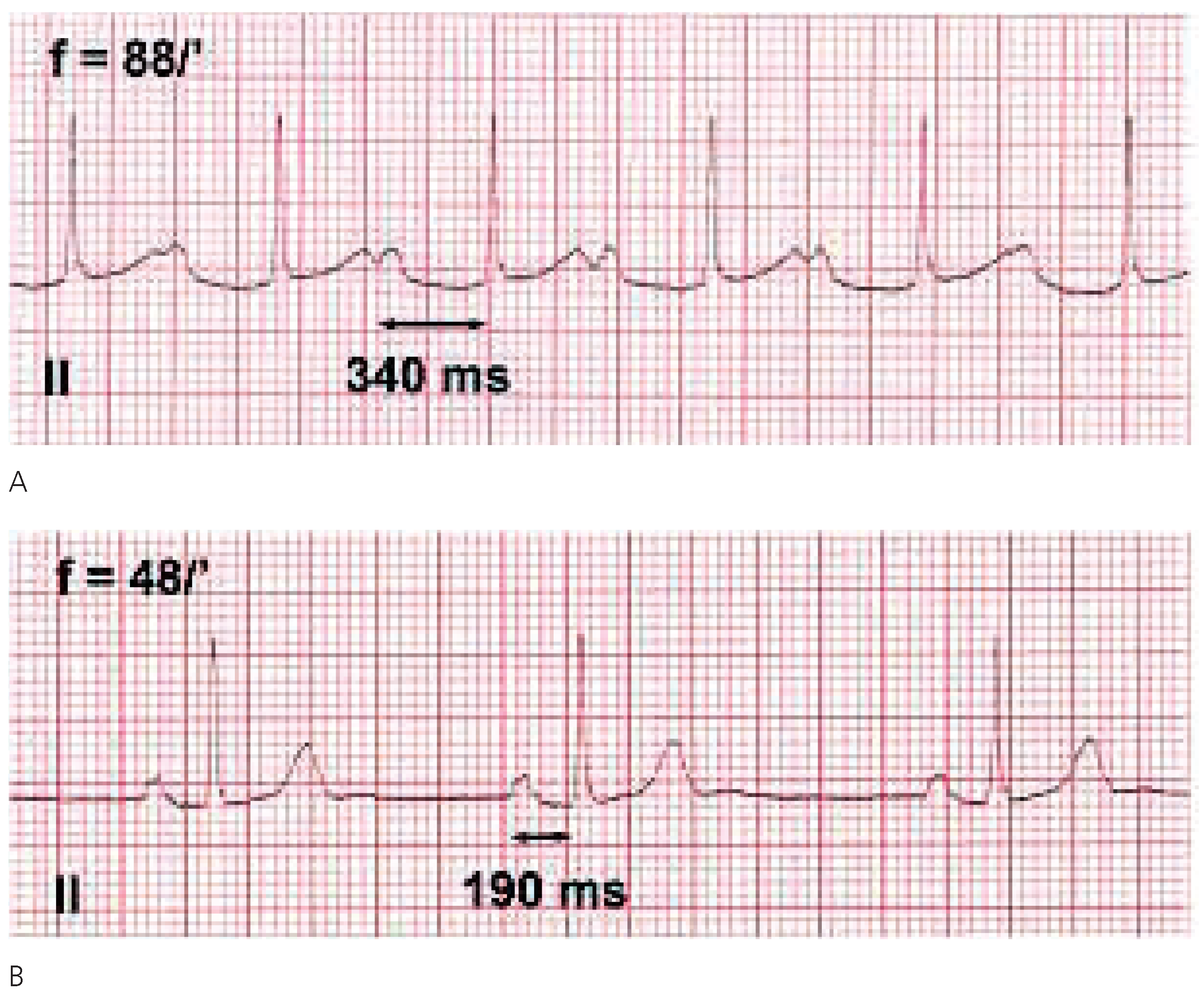Cardiovascmed 08 00148 g001 Cardiovascmed 08 00148 g001