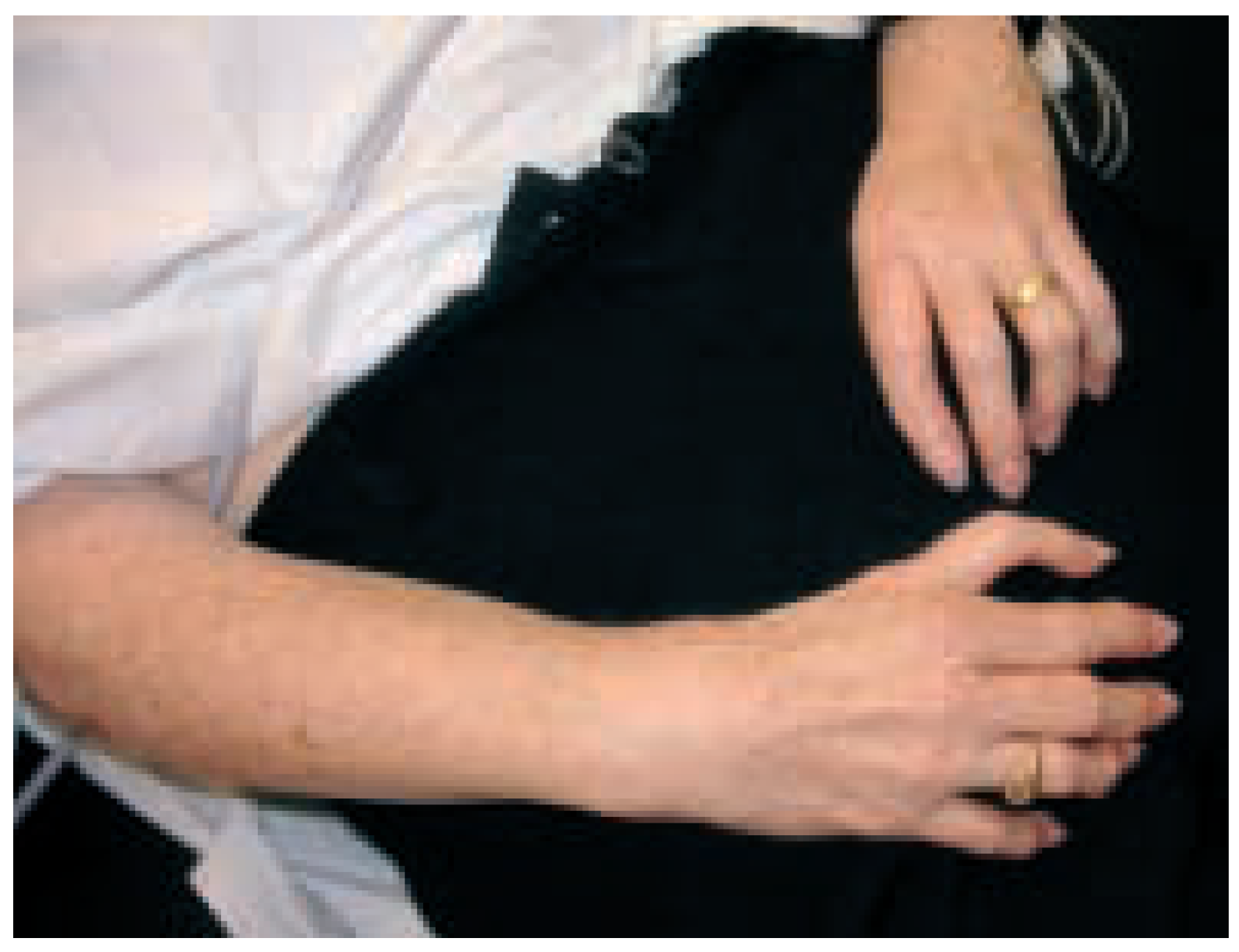 Cardiovascmed 08 00150 g001