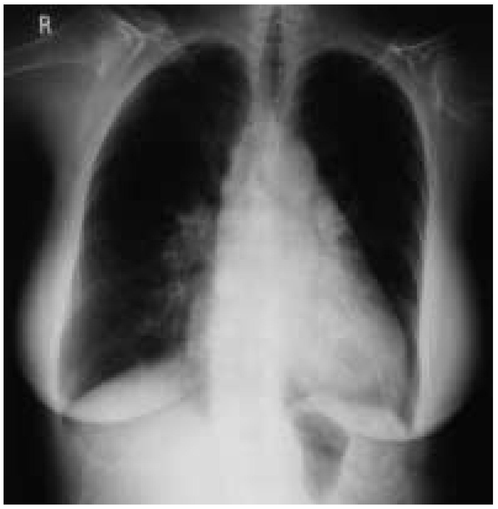 Cardiovascmed 08 00150 g002