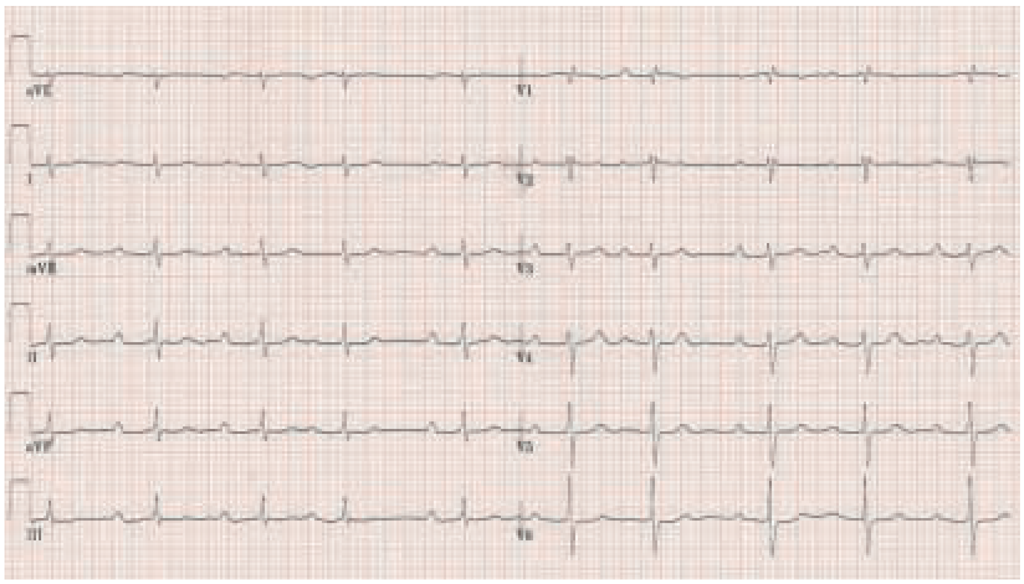 Cardiovascmed 08 00150 g003