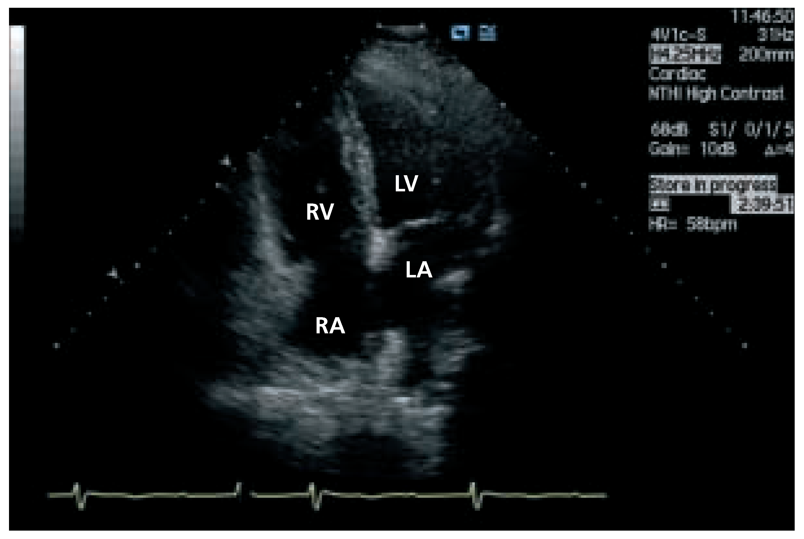 Cardiovascmed 08 00150 g004