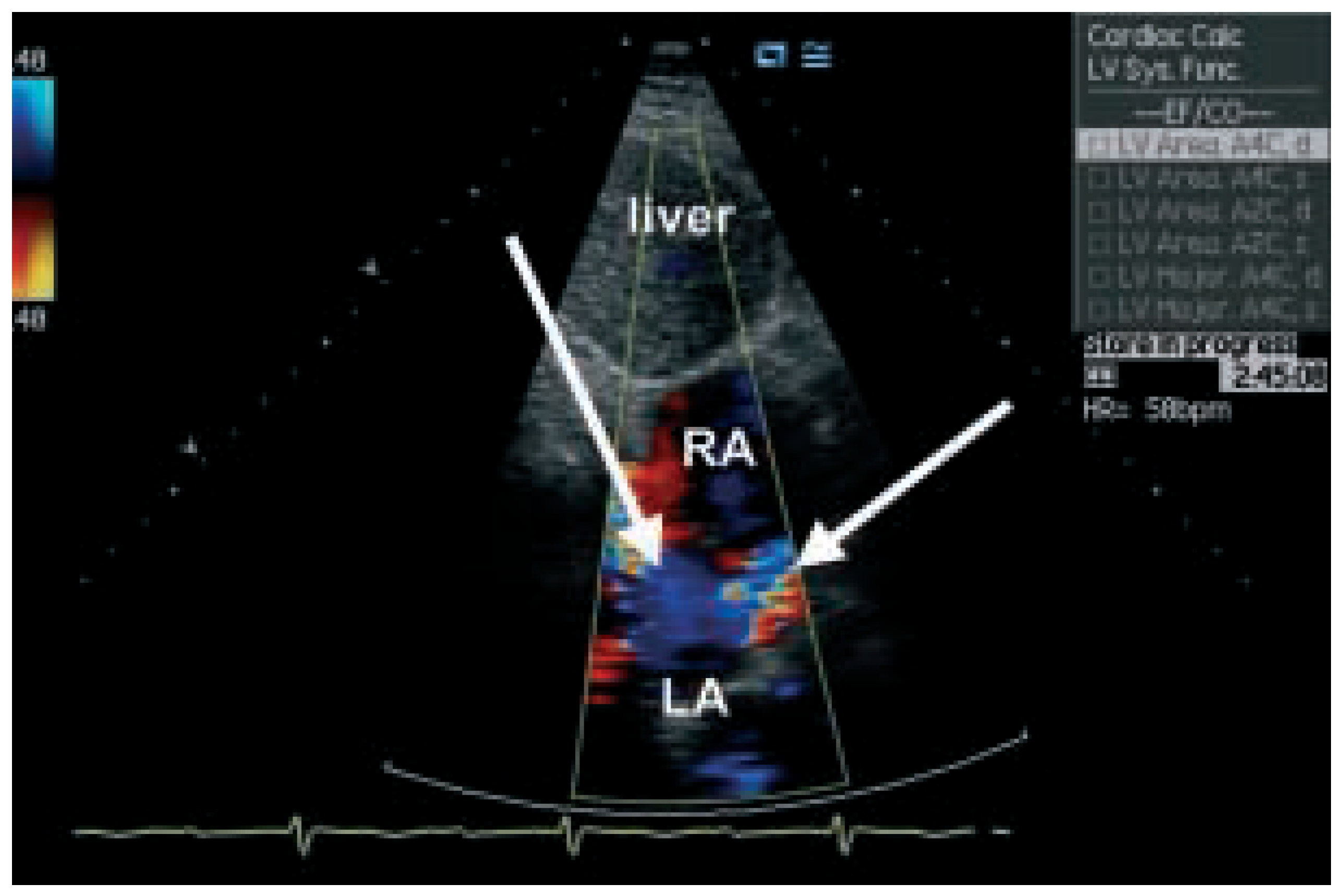 Cardiovascmed 08 00150 g005