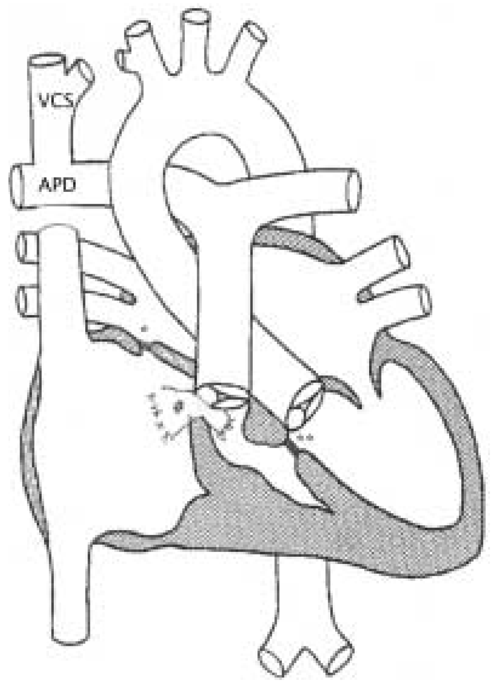 Cardiovascmed 08 00207 g001 Cardiovascmed 08 00207 g001