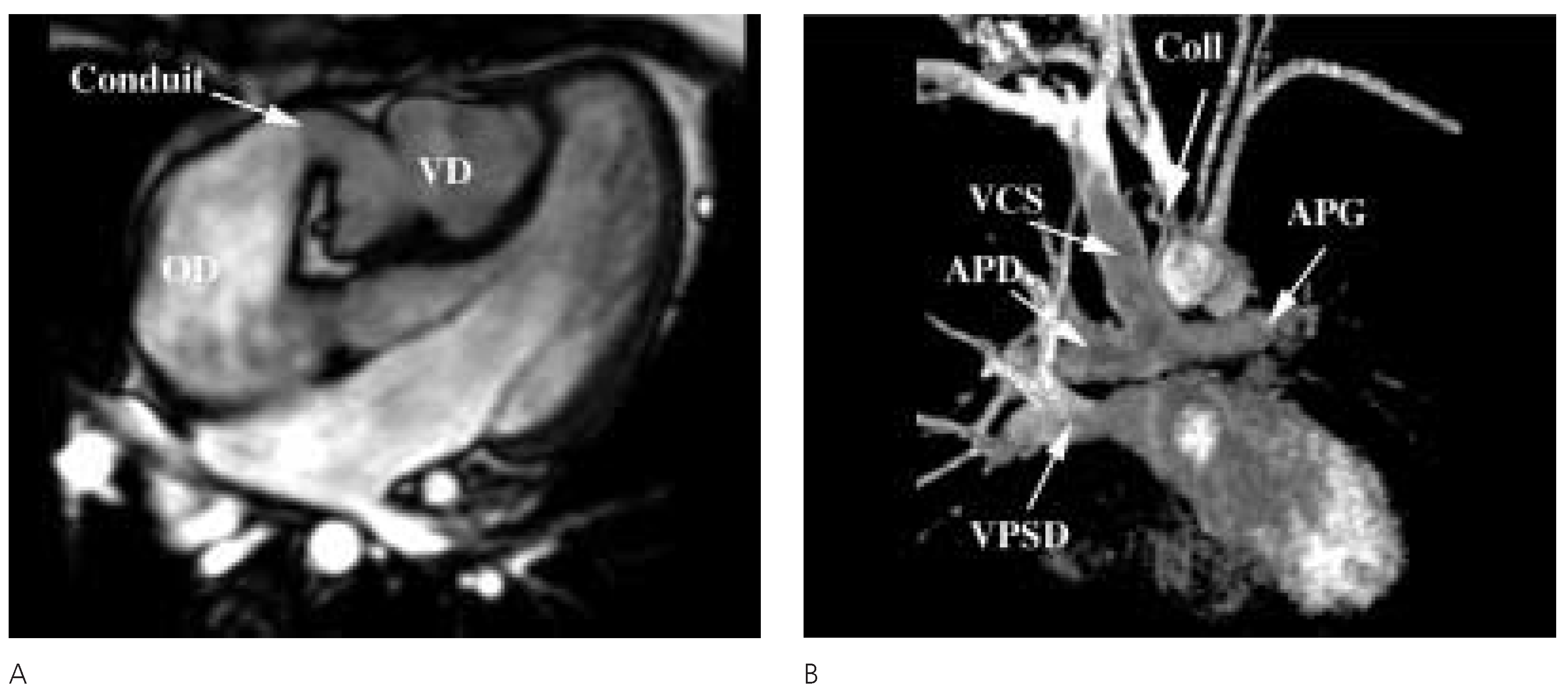 Cardiovascmed 08 00207 g002 Cardiovascmed 08 00207 g002