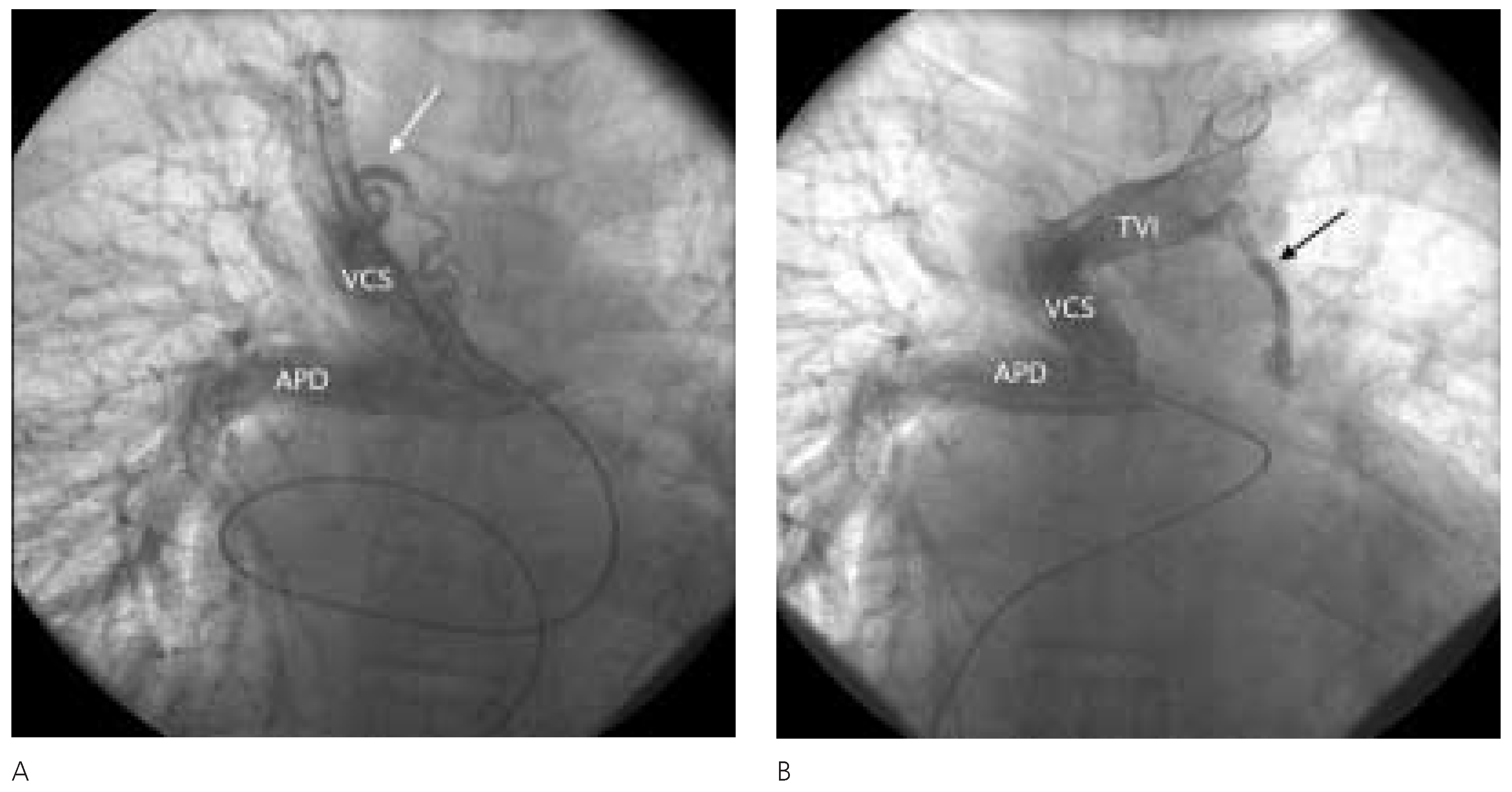 Cardiovascmed 08 00207 g003 Cardiovascmed 08 00207 g003