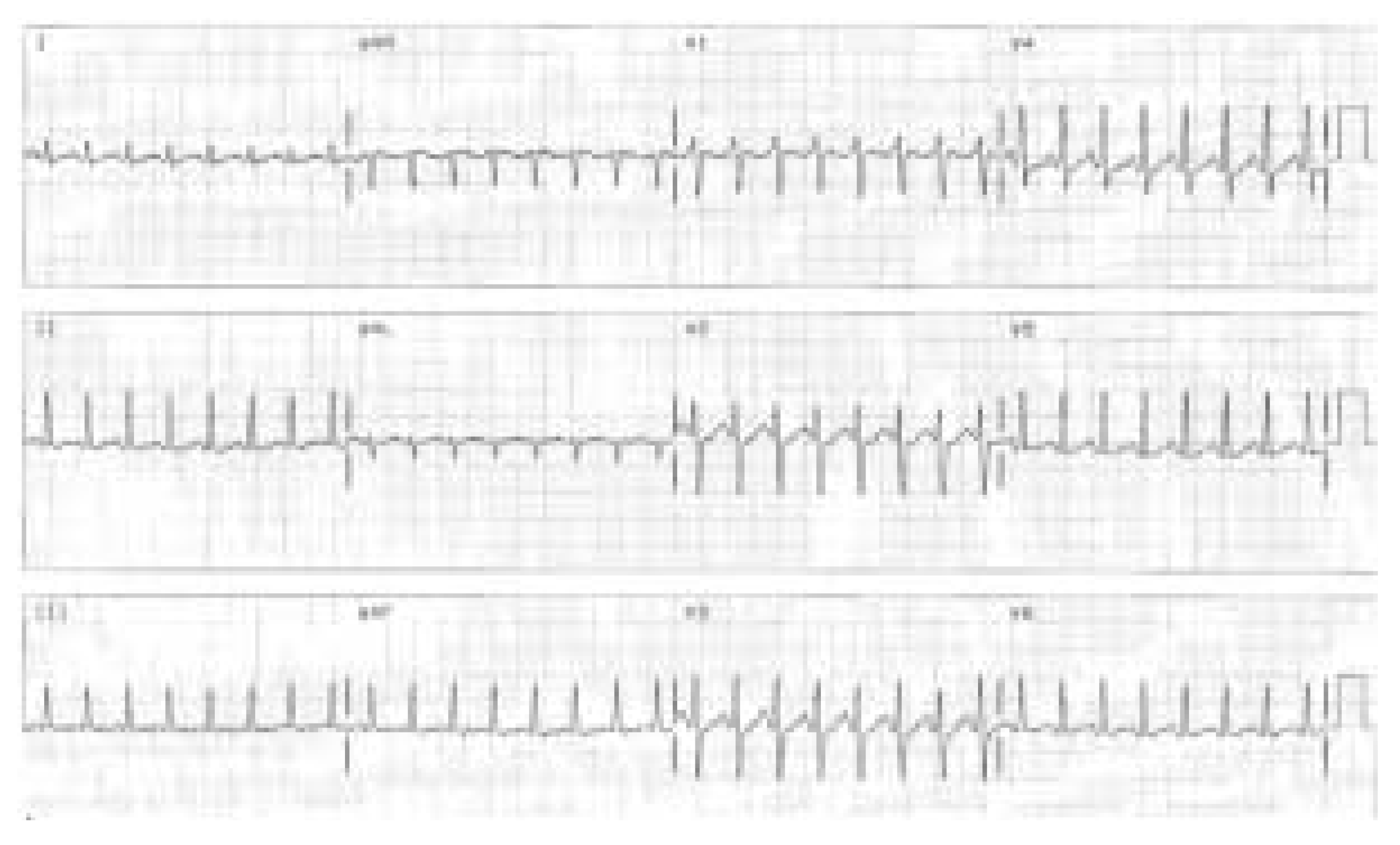 Cardiovascmed 08 00248 g001