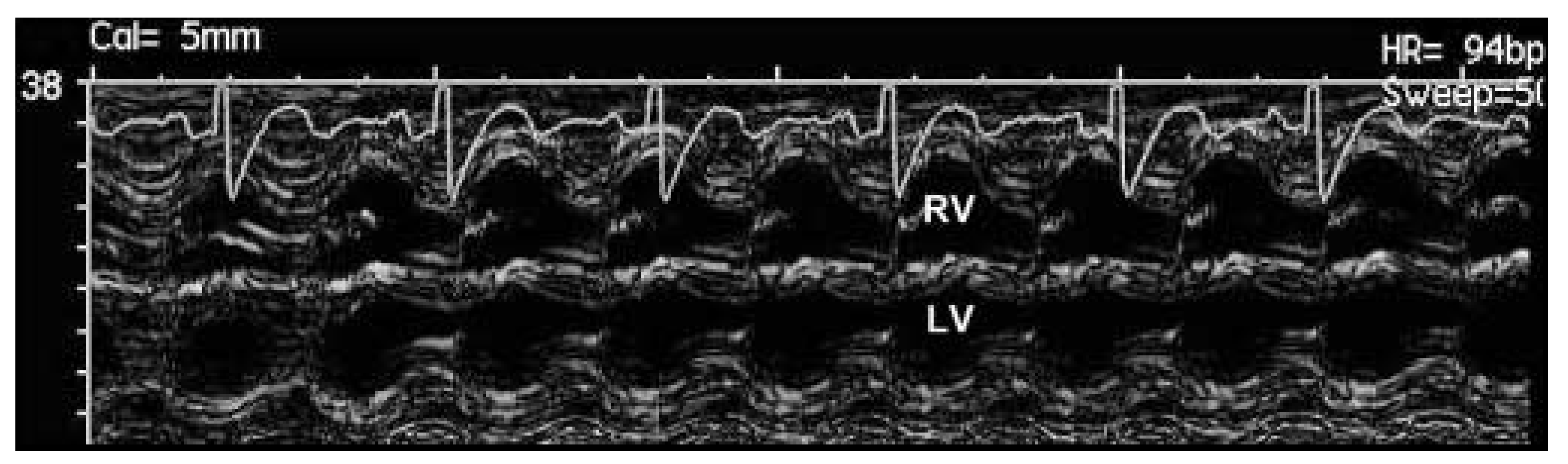 Cardiovascmed 08 00249 g001