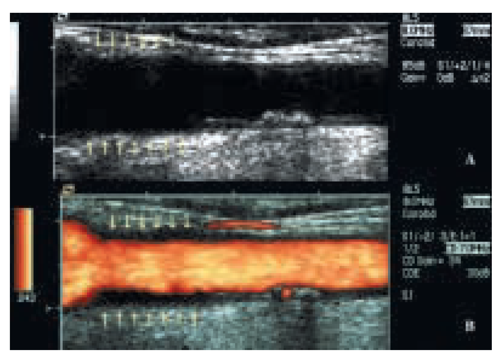 Cardiovascmed 08 00270 g001 Cardiovascmed 08 00270 g001
