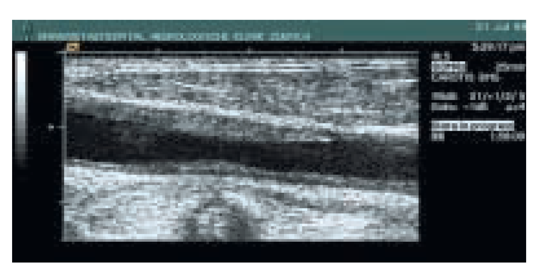 Cardiovascmed 08 00270 g002 Cardiovascmed 08 00270 g002