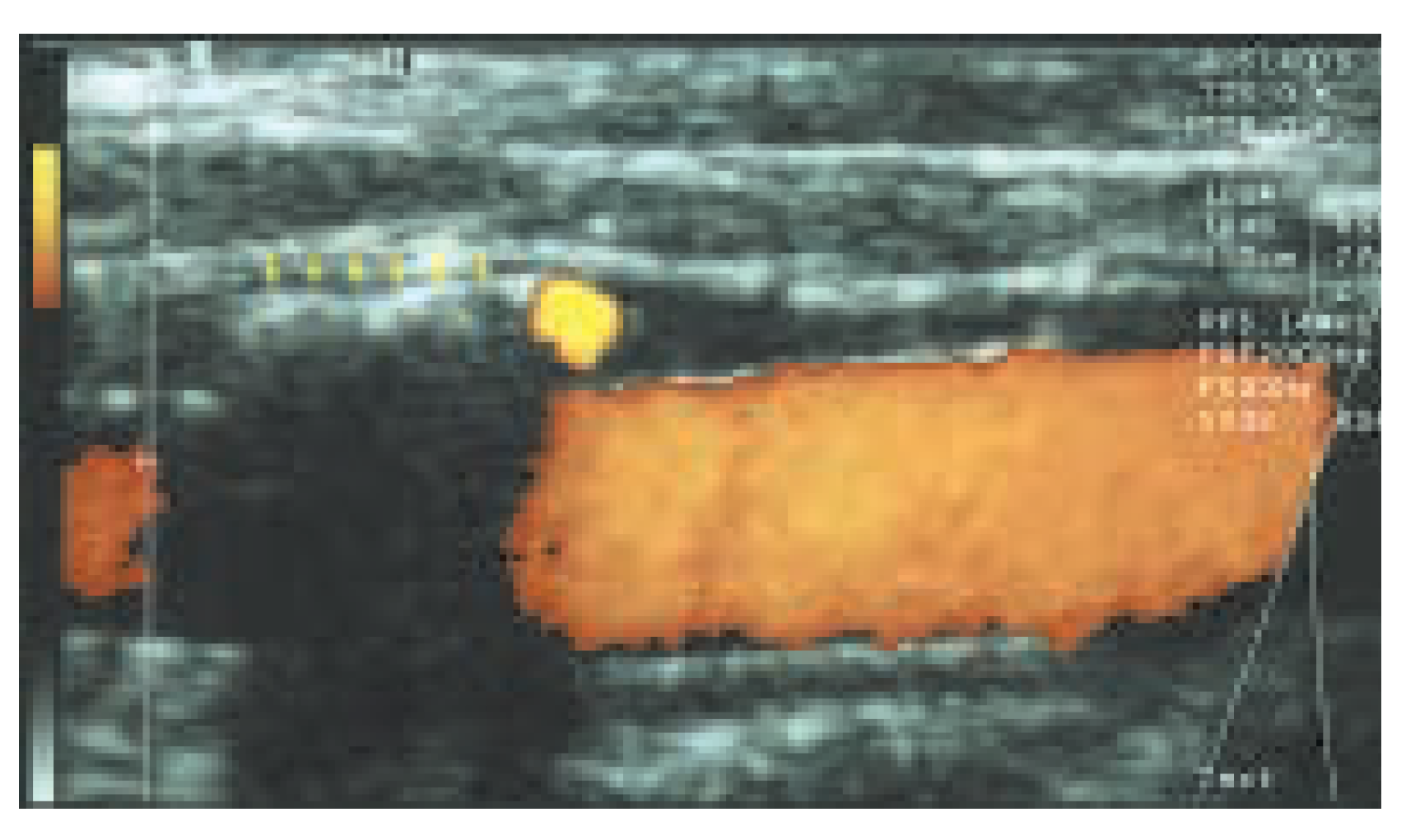 Cardiovascmed 08 00270 g003 Cardiovascmed 08 00270 g003
