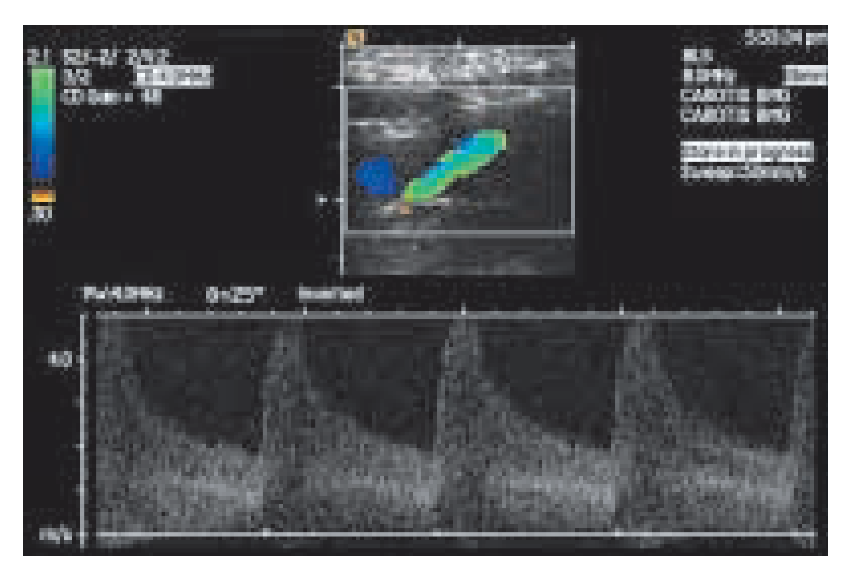 Cardiovascmed 08 00270 g004 Cardiovascmed 08 00270 g004