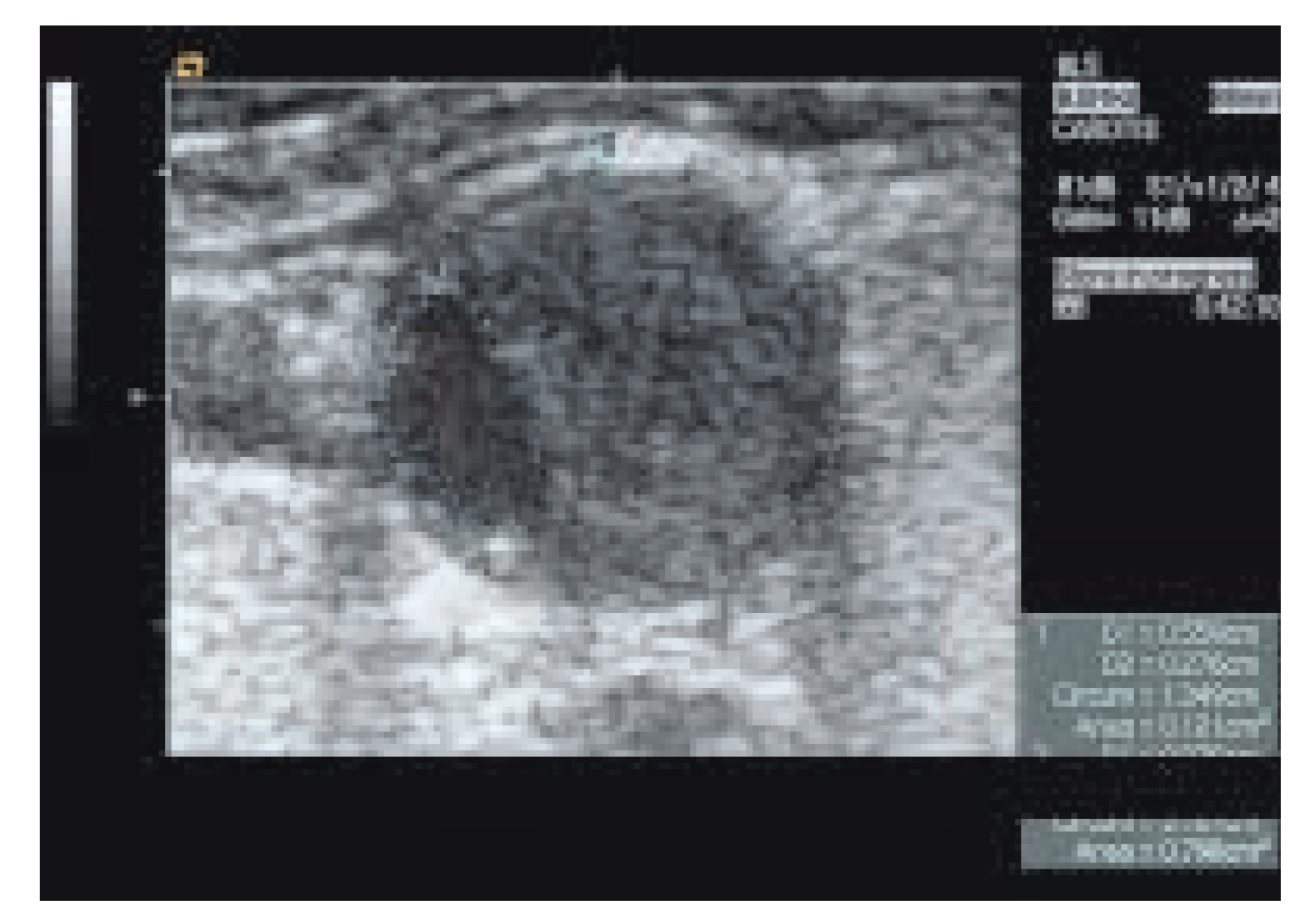 Cardiovascmed 08 00270 g005 Cardiovascmed 08 00270 g005