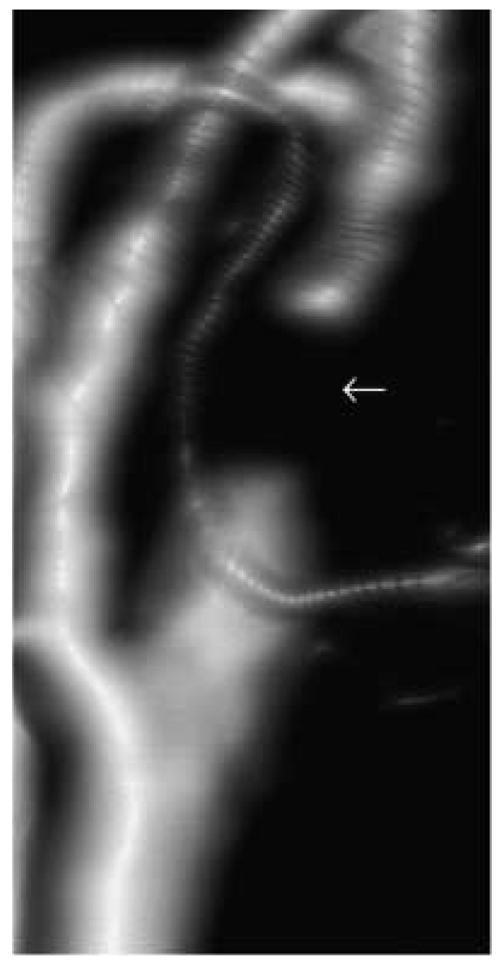 Cardiovascmed 08 00270 g007 Cardiovascmed 08 00270 g007