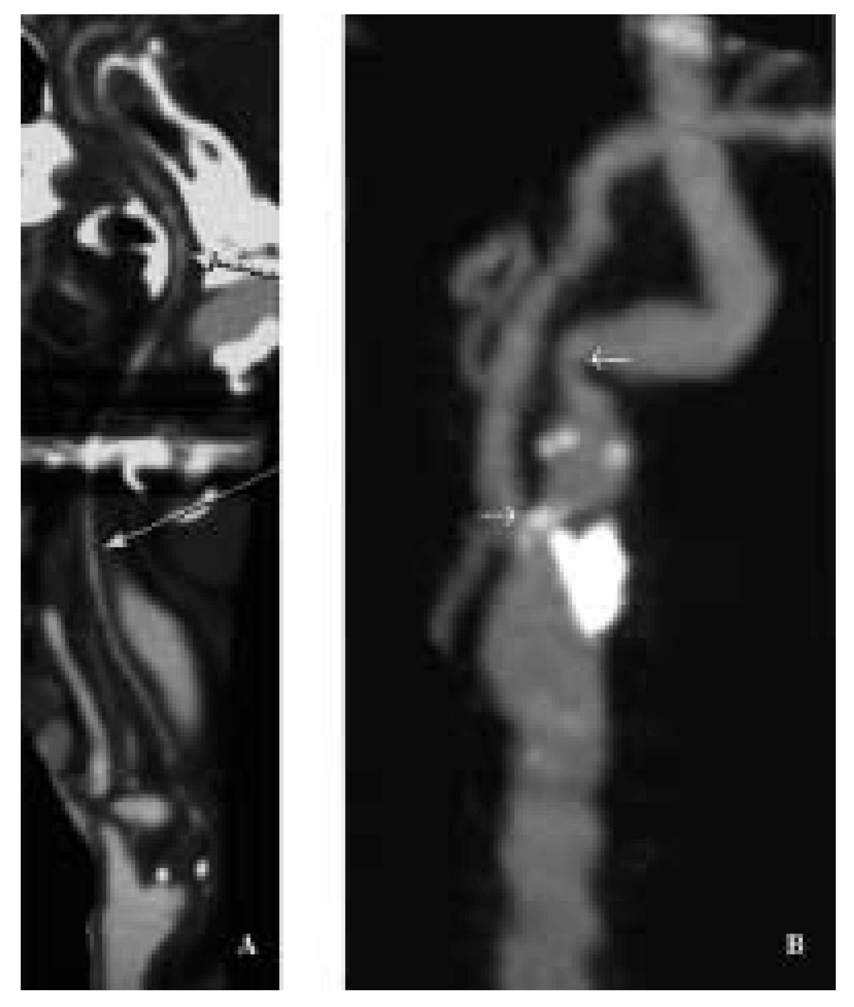 Cardiovascmed 08 00270 g008 Cardiovascmed 08 00270 g008