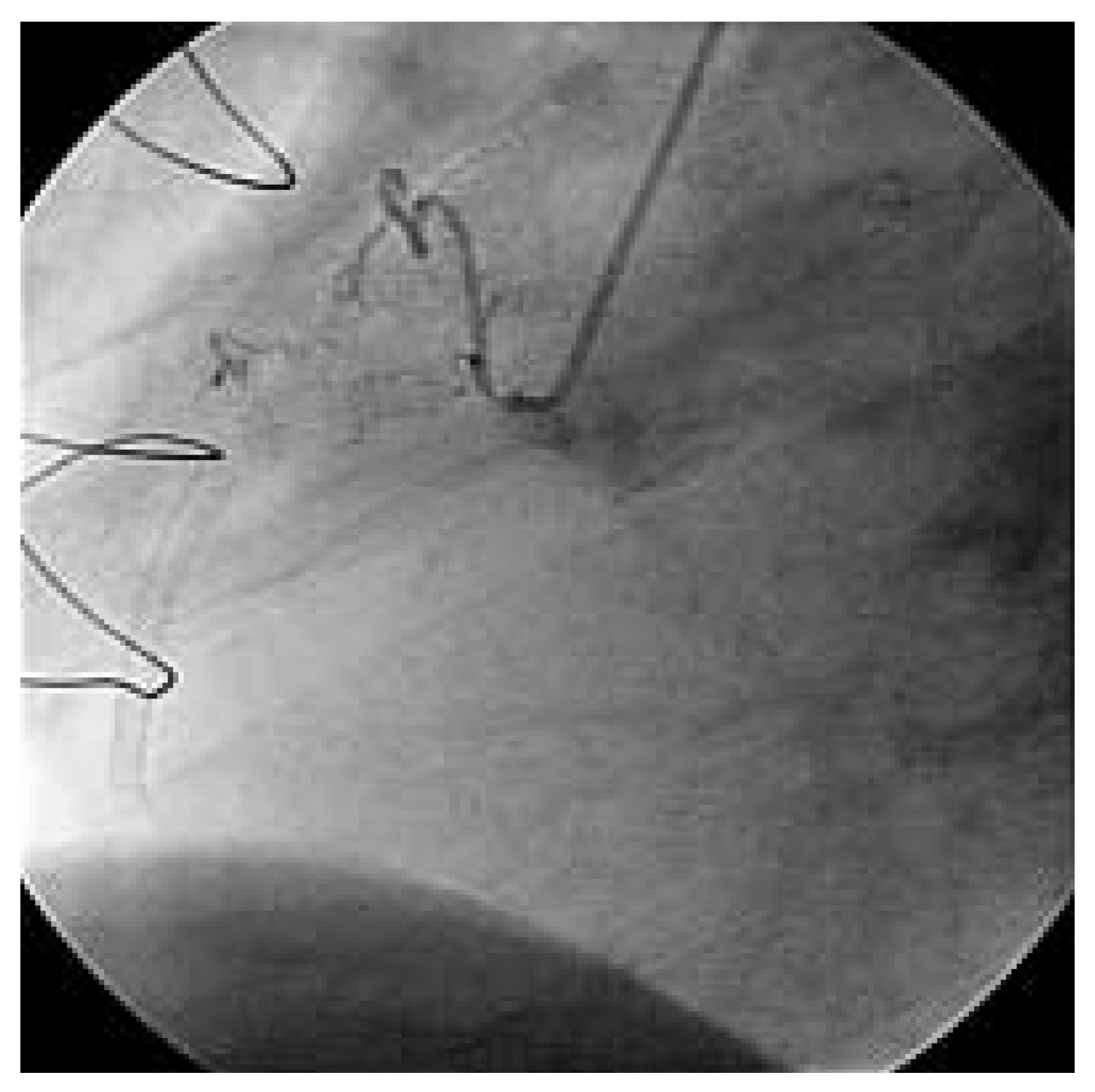 Cardiovascmed 08 00290 g002