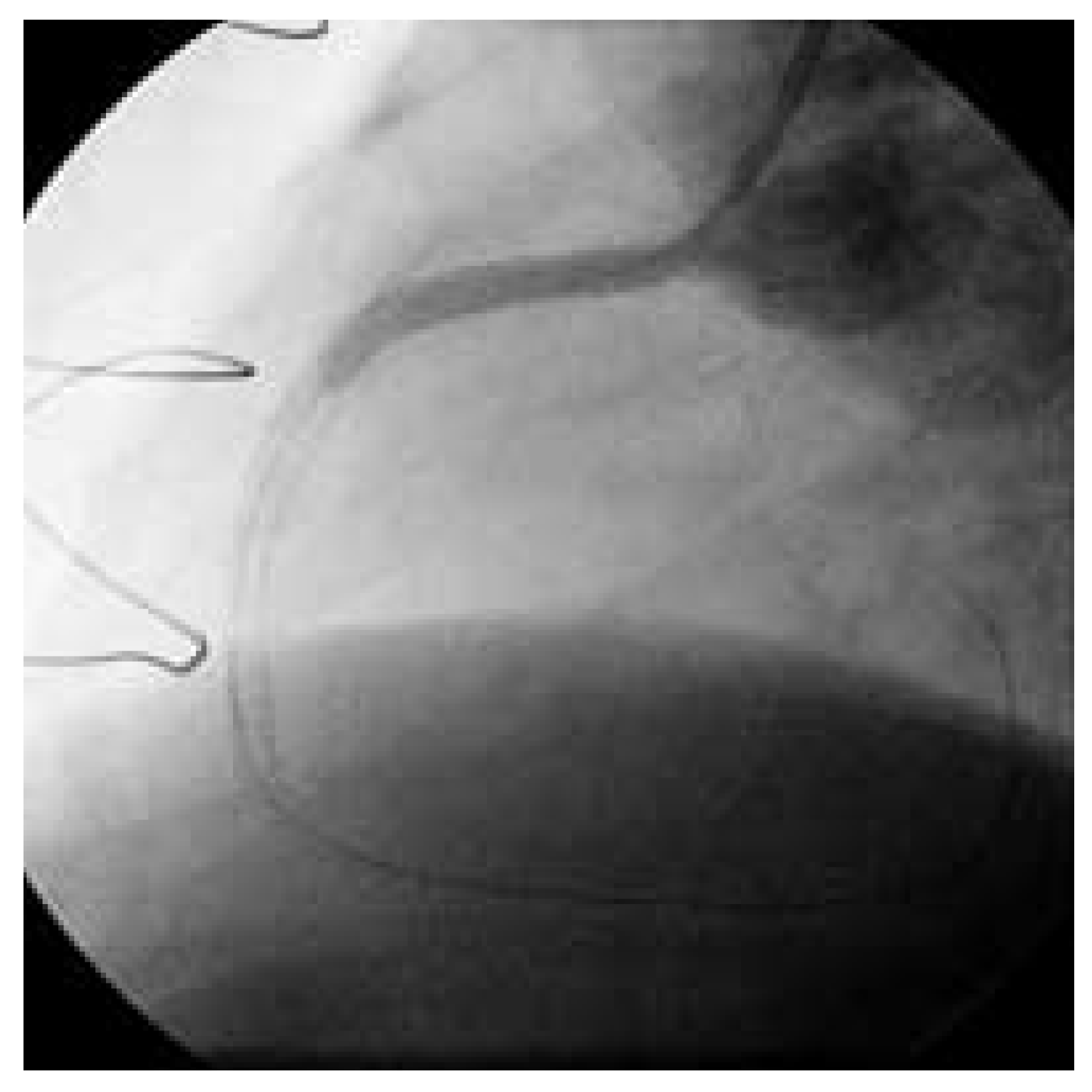 Cardiovascmed 08 00290 g003