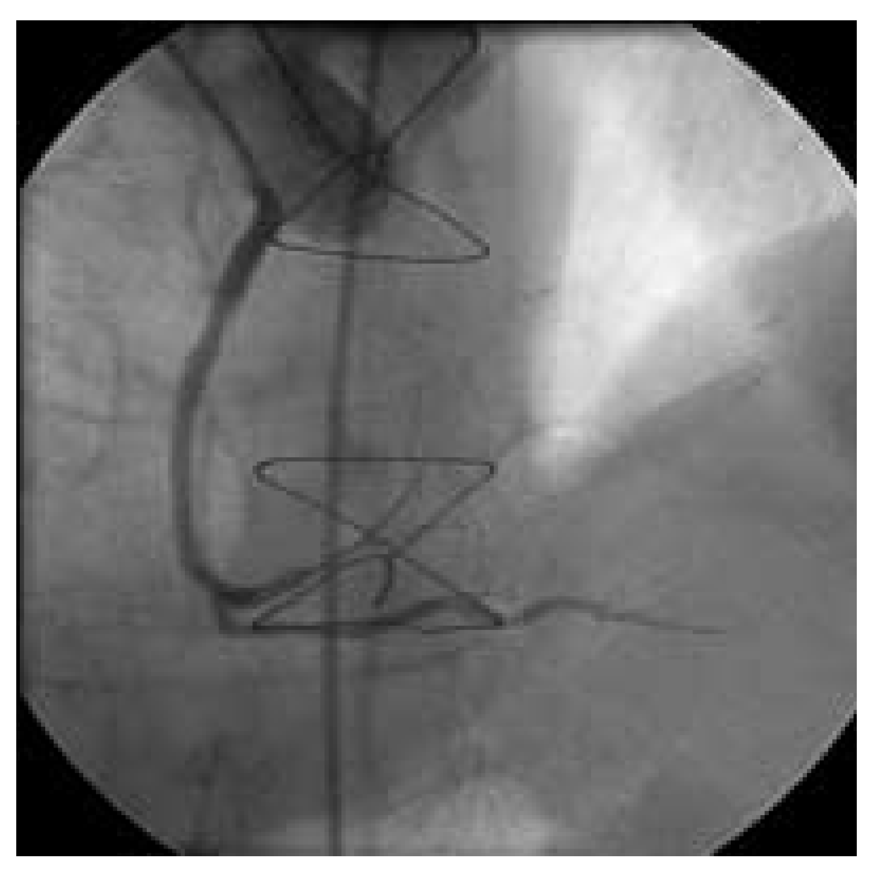 Cardiovascmed 08 00290 g004