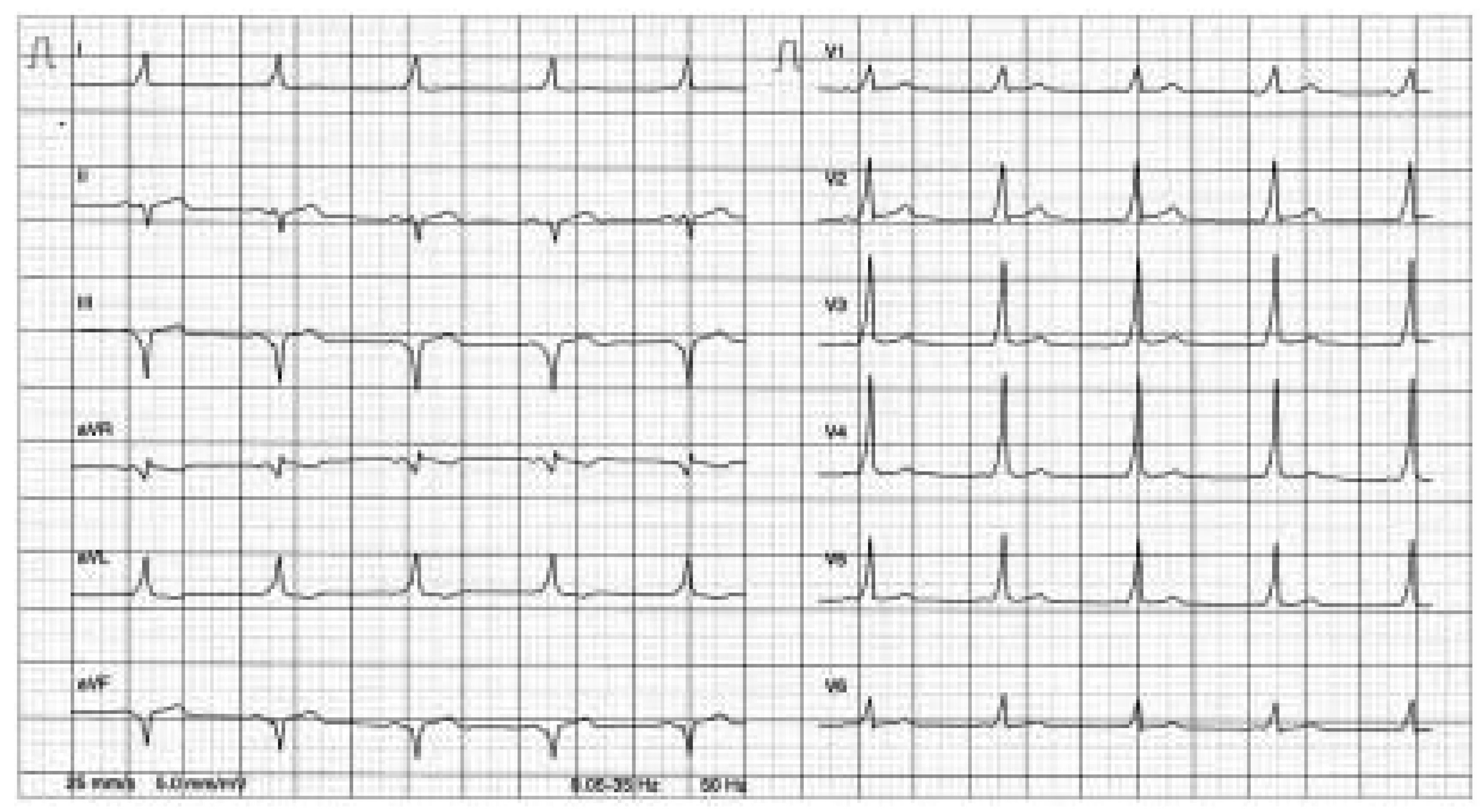 Cardiovascmed 08 00295 g001