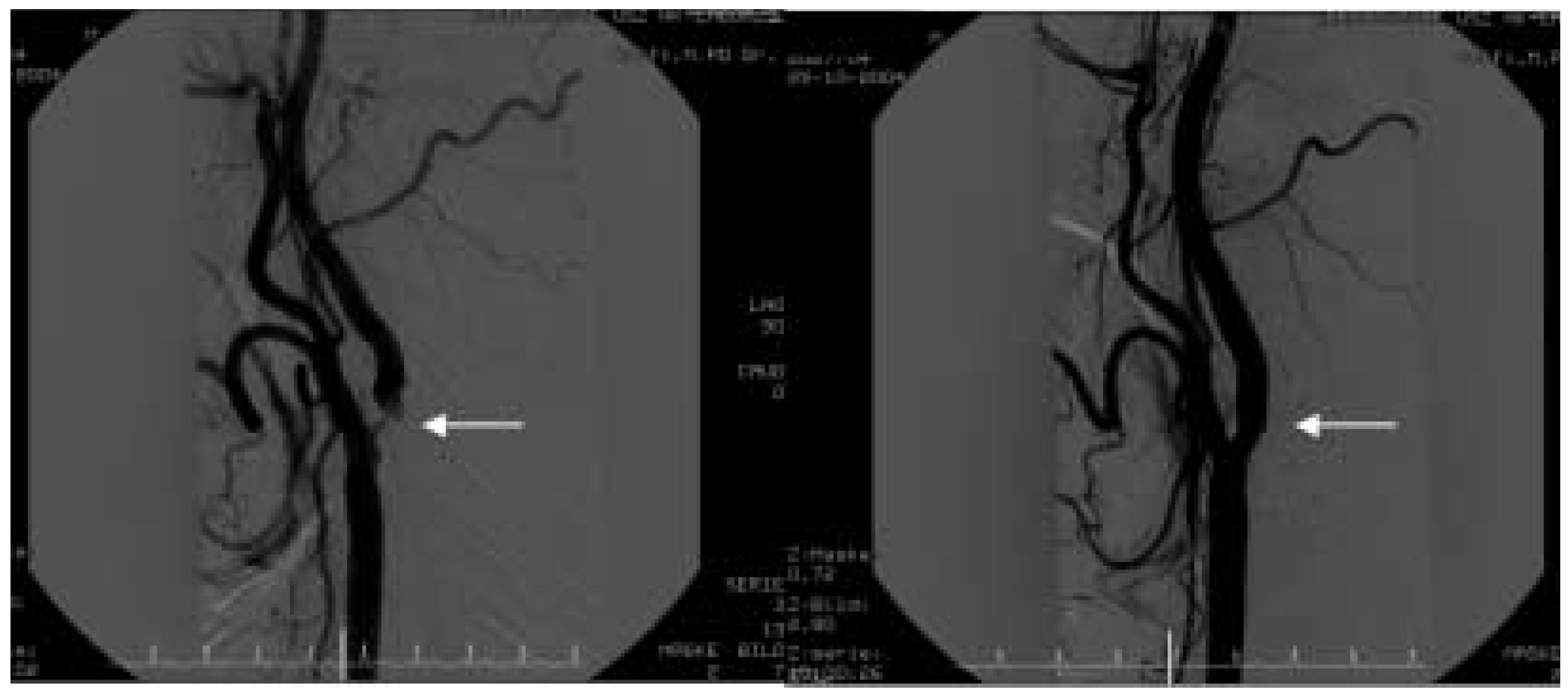 Cardiovascmed 08 00306 g001