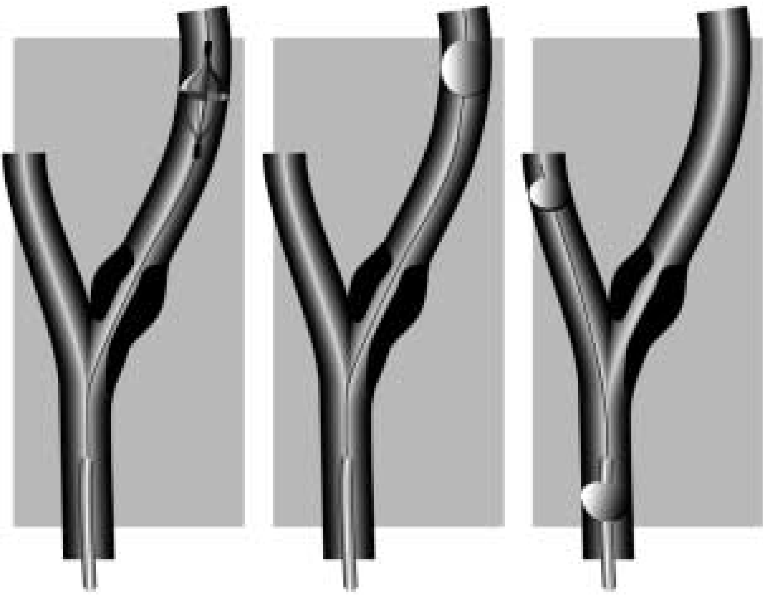 Cardiovascmed 08 00306 g003